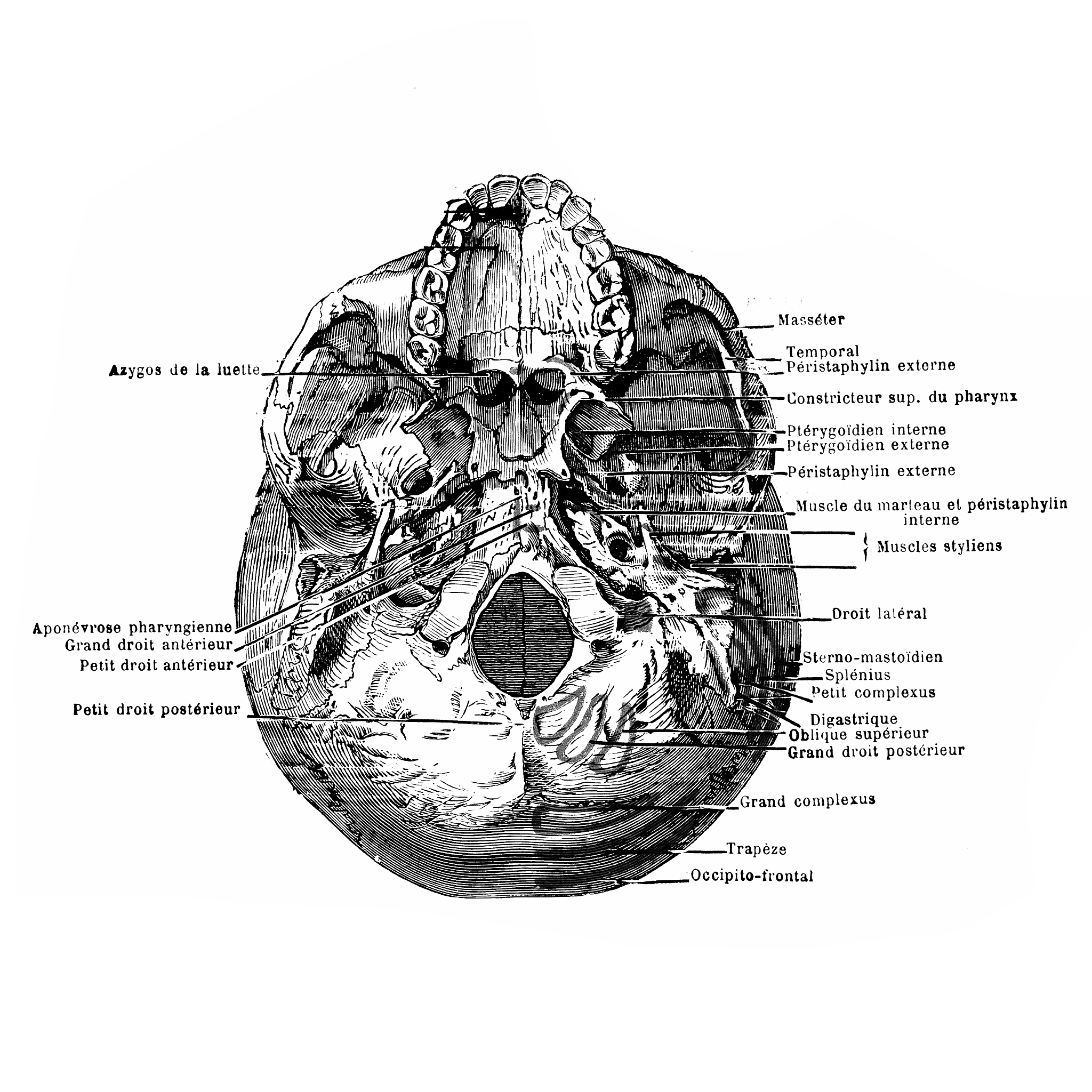 Dizziness, Weakness, and Unconsciousness: Identifying Cerebral Bridge Hemorrhage