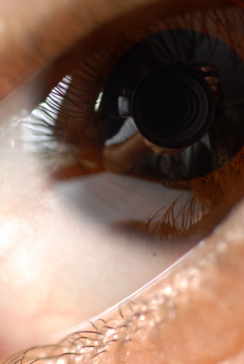 家长抱着眼睛进铁屑的患儿急冲冲的冲进诊室 家长抱着眼睛进铁屑的患儿急冲冲的冲进诊室