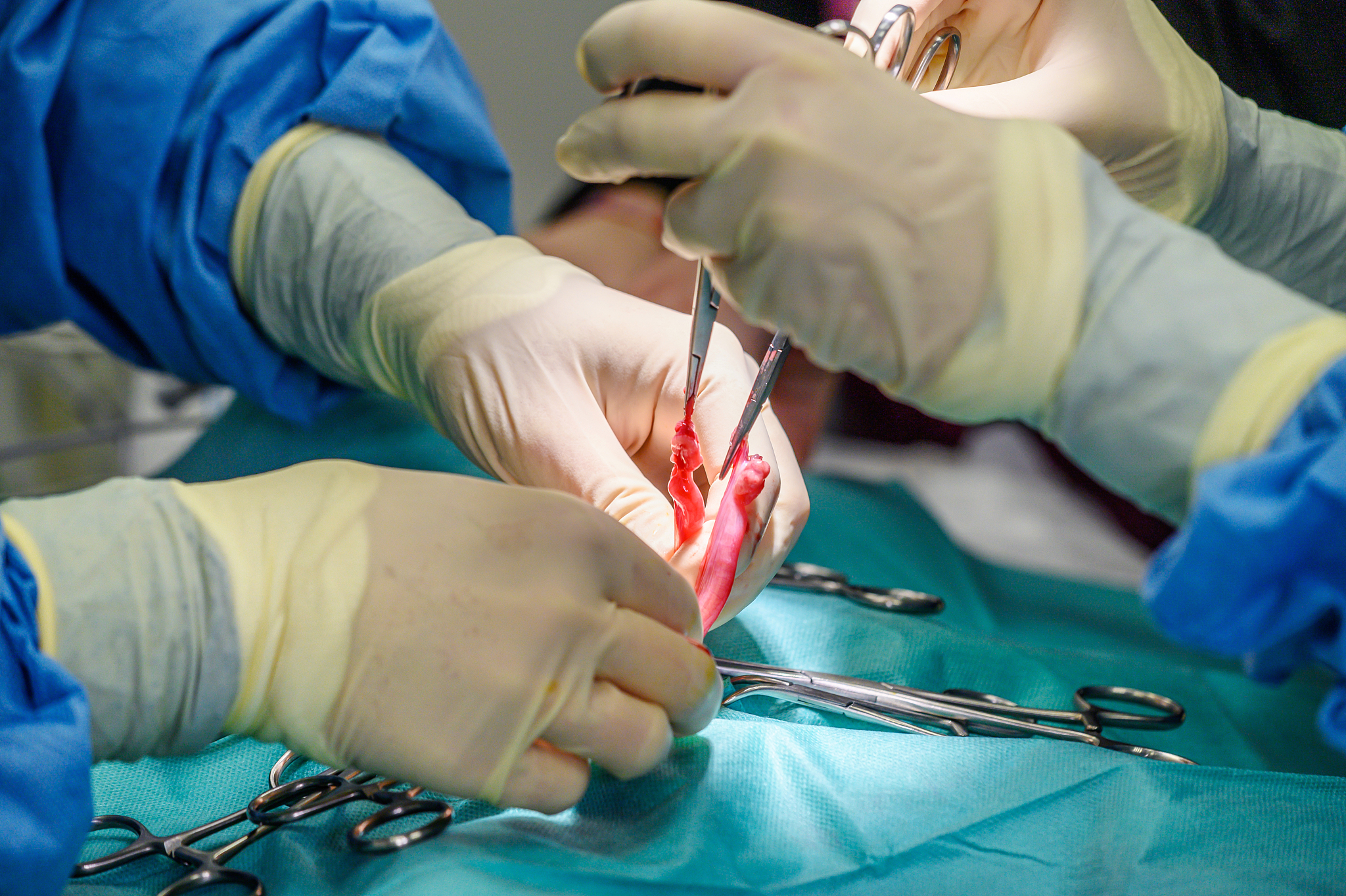 close-up, hands of the professional surgeon, doing surgery. in t