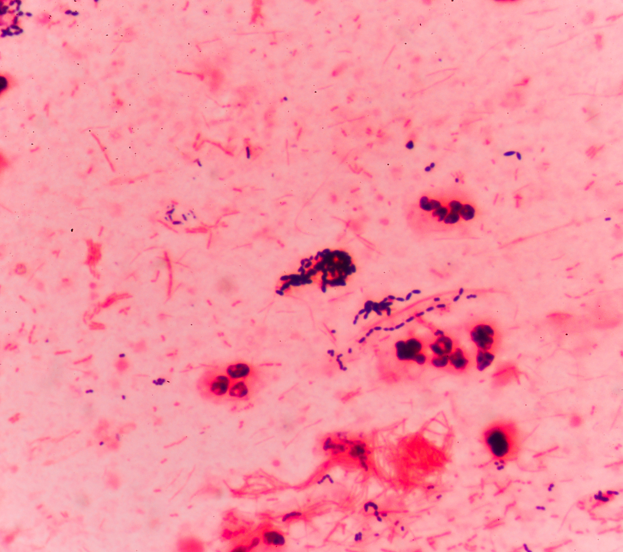 Marvinbryantia菌属在溃疡性结肠炎患者中的表现趋势以及它的主要作用？