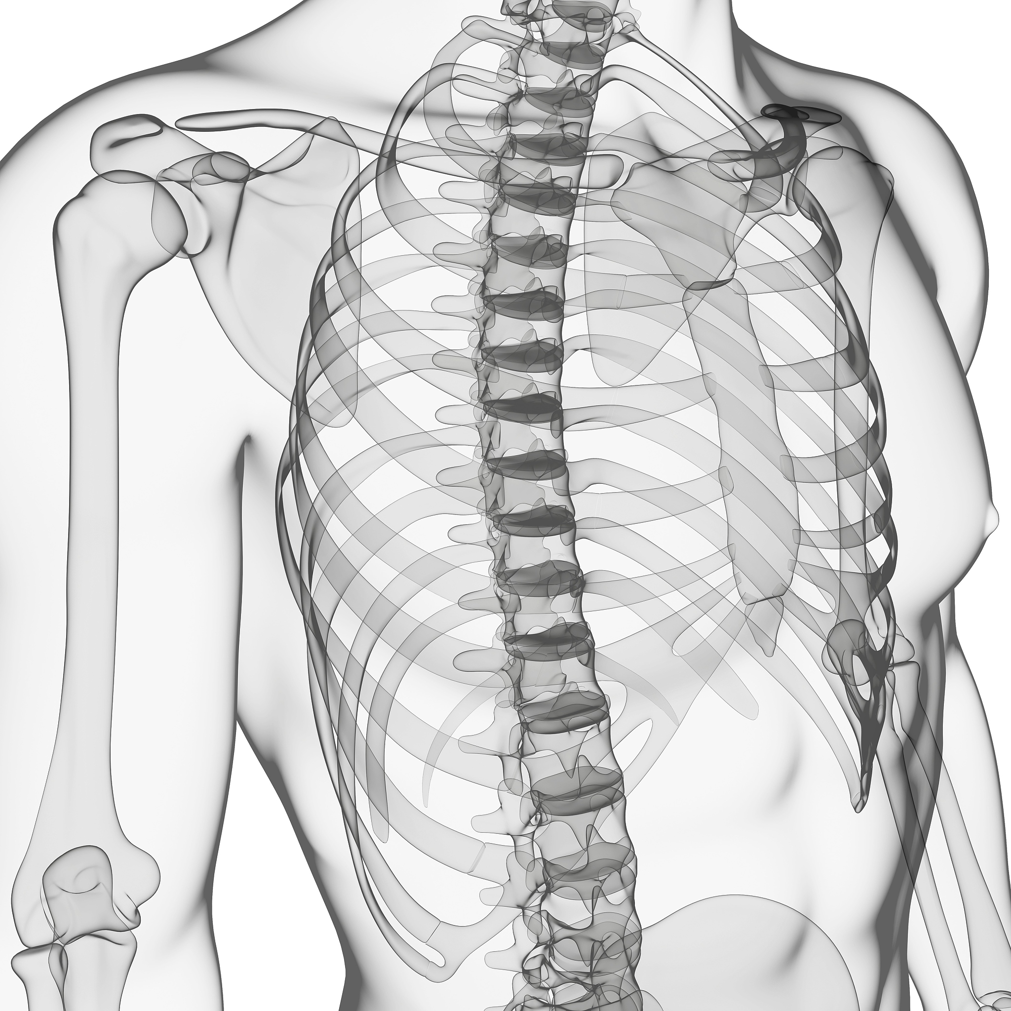 排骨胸怎么改善，