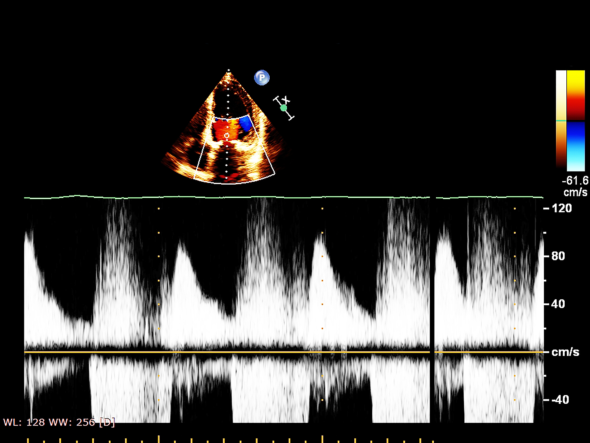 超声波：原理、特性及应用领域详解