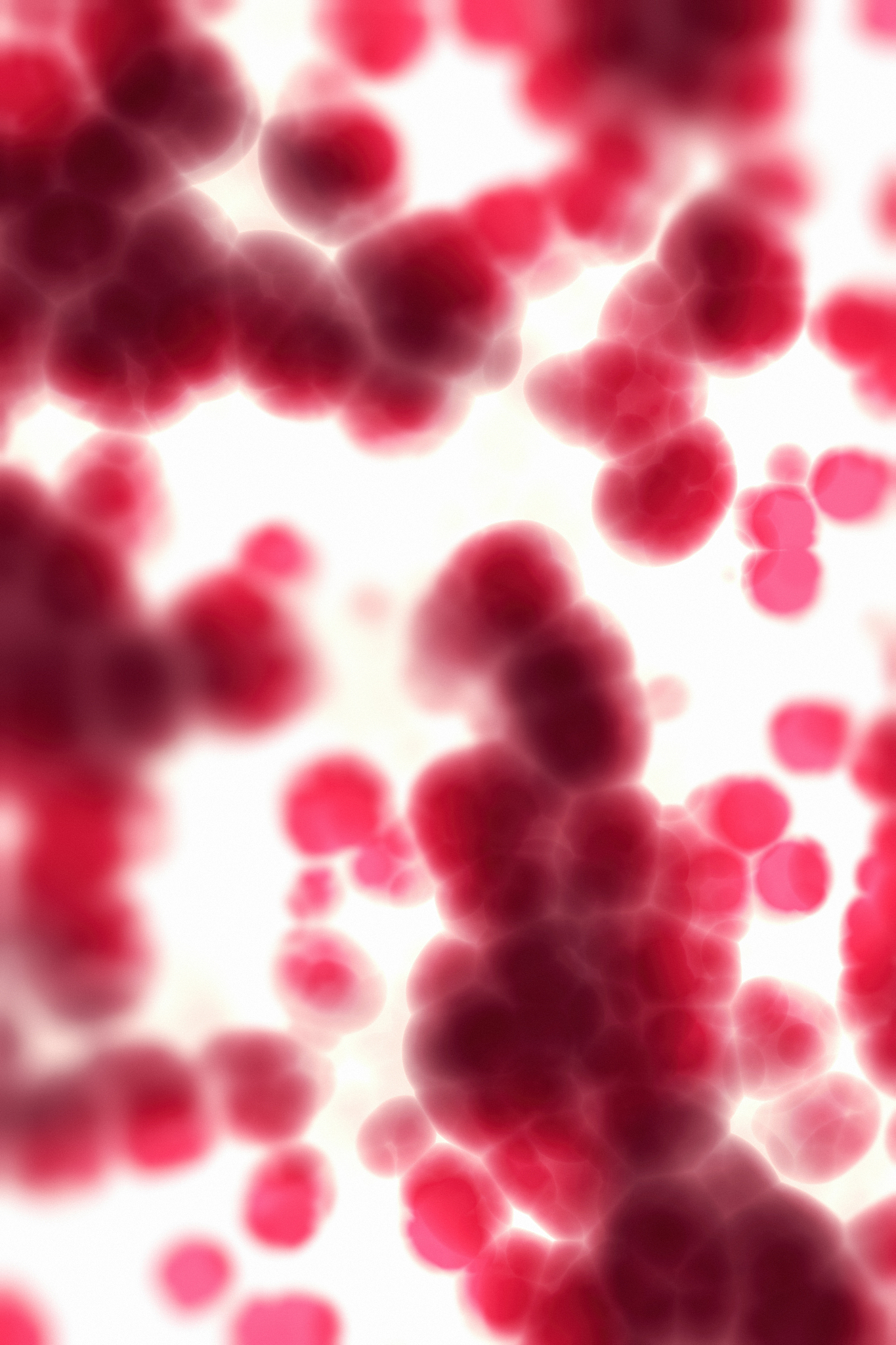 Packed Cell Volume (PCV) 和 Hematocrit: 它们是一样的吗？