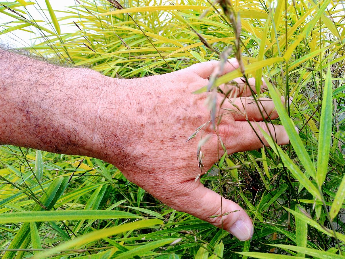 湿疹：症状、原因、治疗方法和预防 - 全面指南