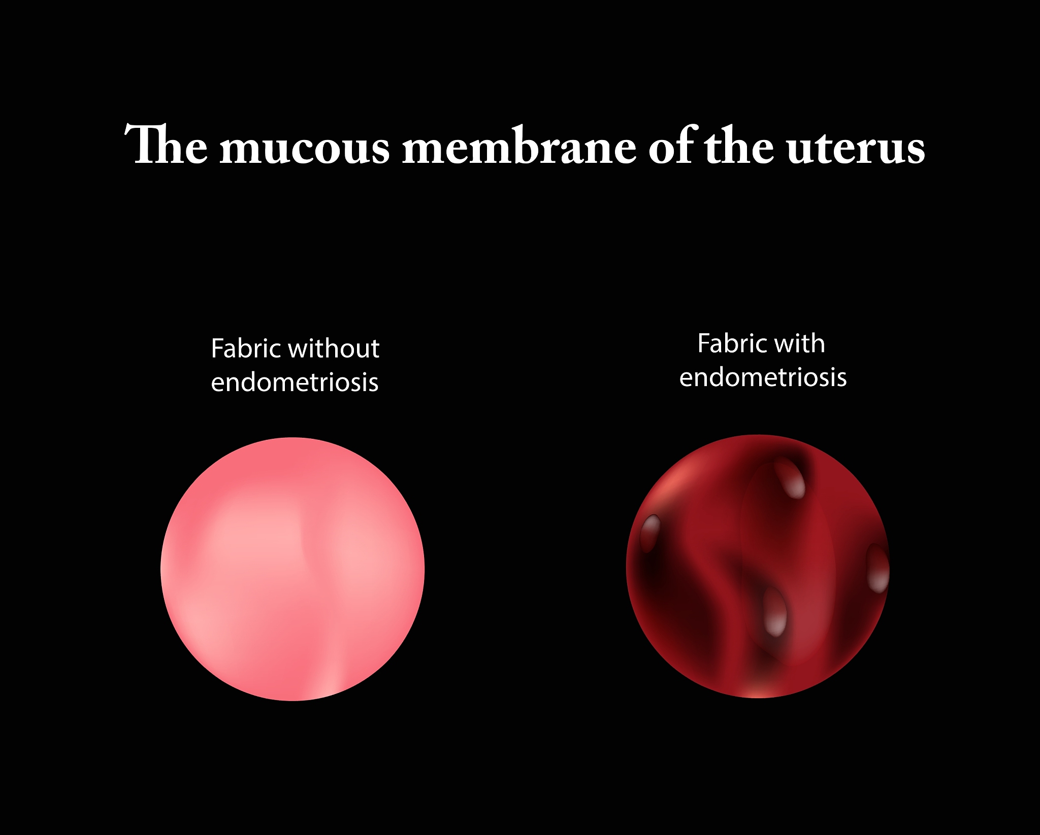 为什么经期推迟