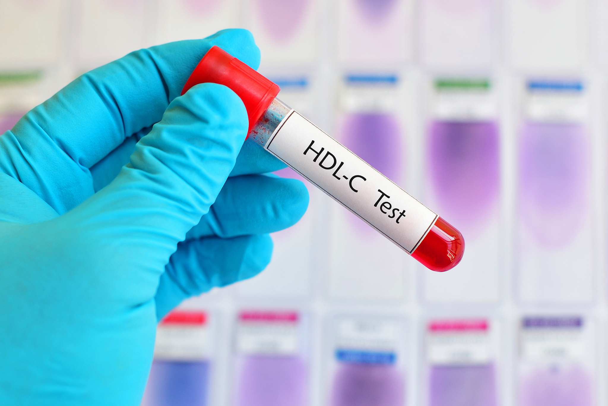 番茄红素软胶囊降胆固醇？有效吗？