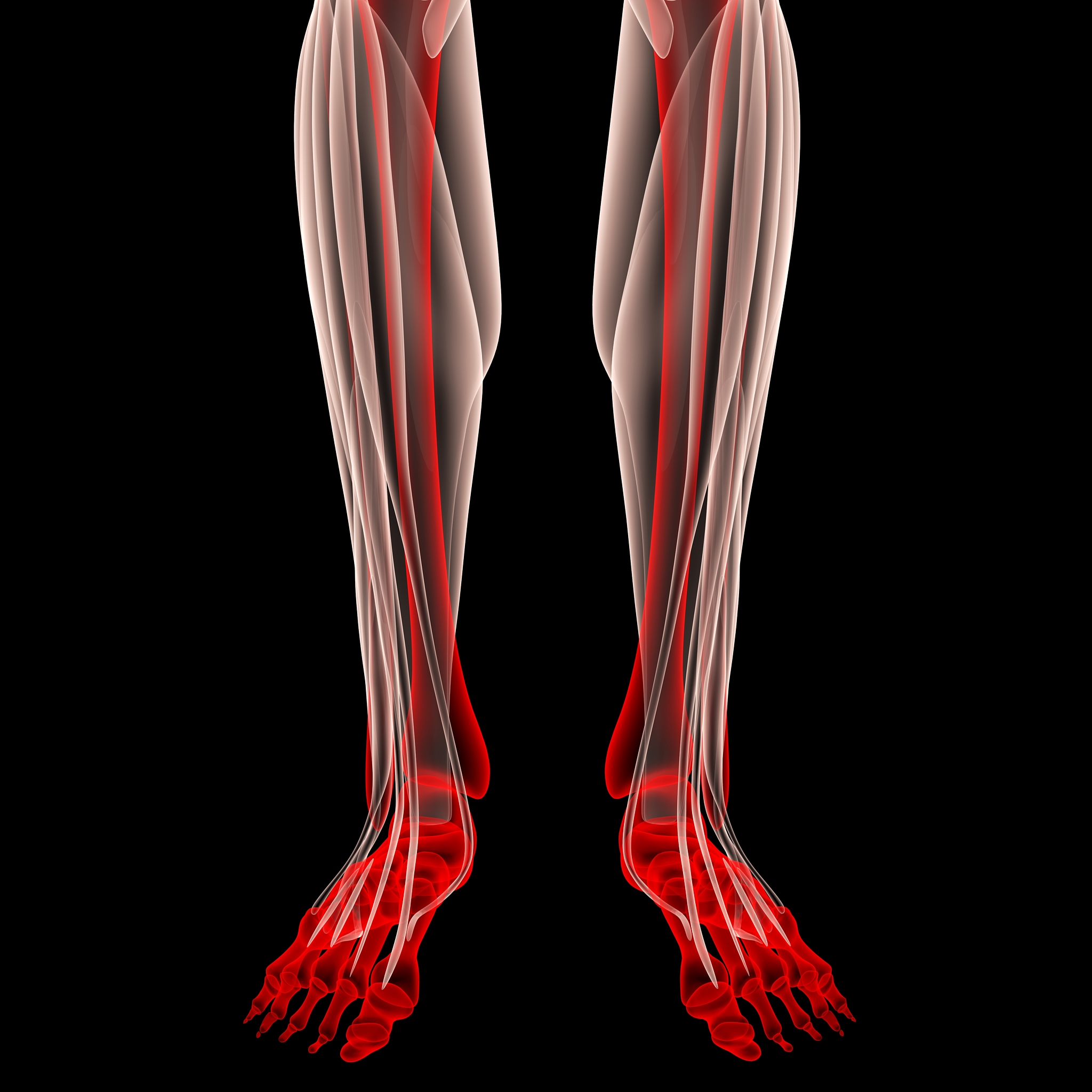 跑步后小腿后肌肉痛有可能是韧带拉伤吗？