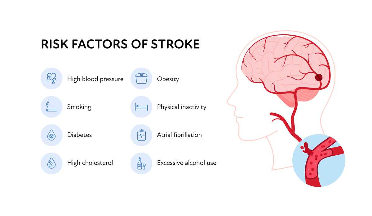 35	The	part	of	the	brain	that	enables	you	to	 feel	someone	holding	your	hand	is	in	the	_____	lobea occipital										 b parietal								 c temporal										 d frontaltly