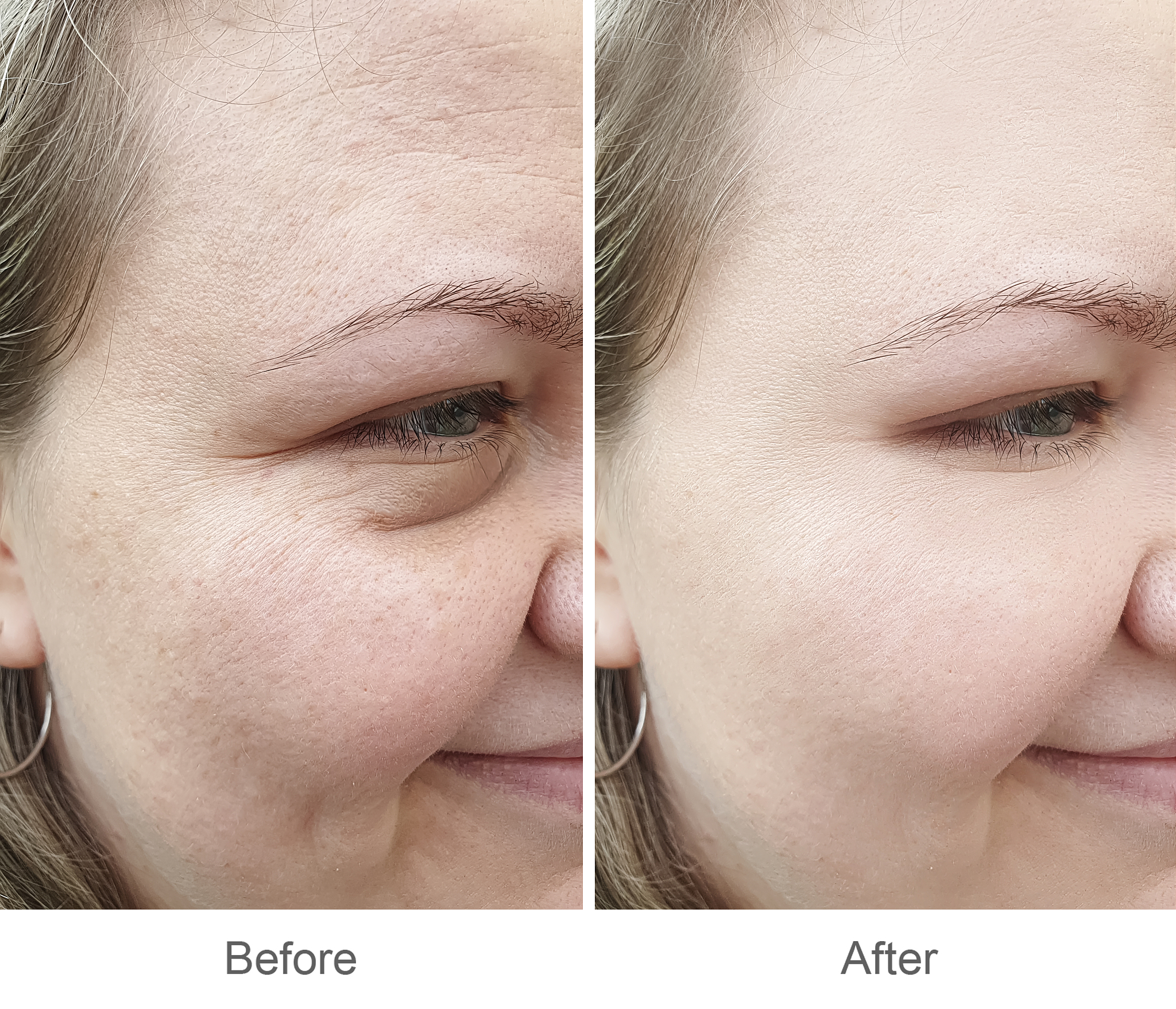 光甘草定护肤前后对比：10个惊人效果！