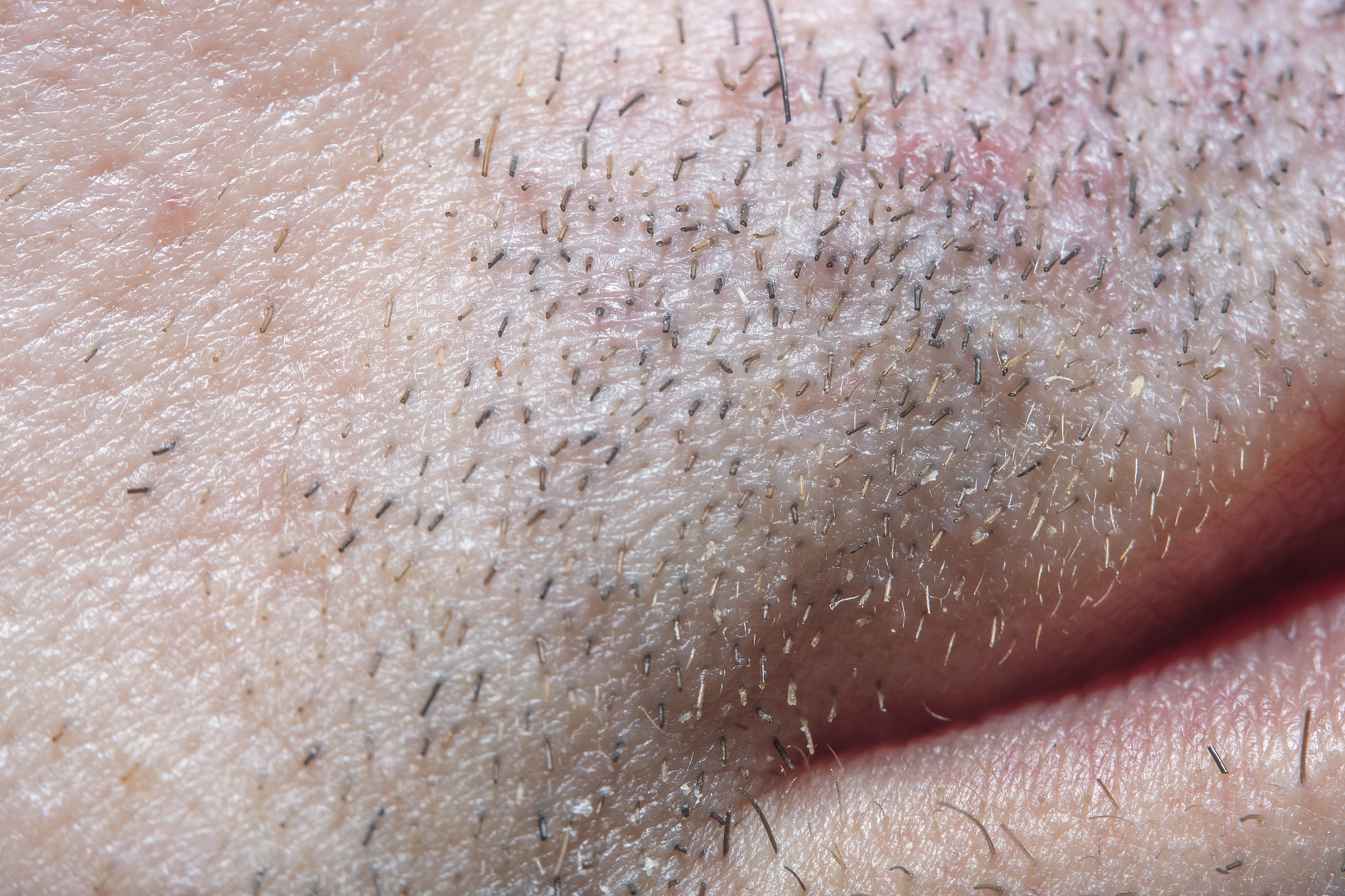 men's skin with the remains of a shaved beard in soft focus with