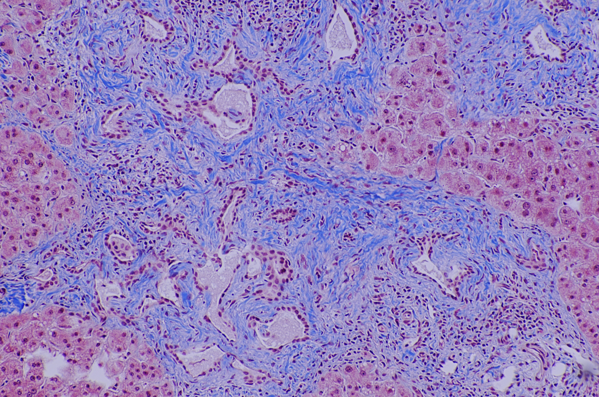 一加仑胆汁：含义及作用