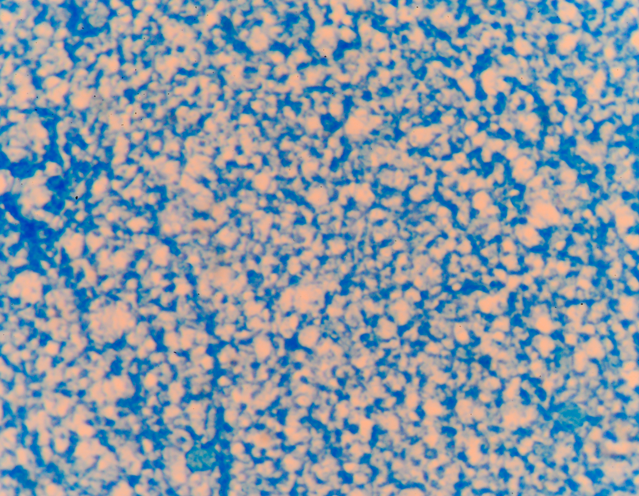 结核继续结核Tuberculosis简称TB是由结核分支杆菌Mycobacterium tuberculosis引起的一种传染病。结核病可累及全身各器官以肺结核最为常见。其传播方式通常是通过空气飞沫传播例如打喷嚏、结核是由结核分枝杆菌感染引起的慢性传染病。结核菌可以侵犯全身任何器官但以肺结核最为常见。约有13的全球人口曾经结核Tuberculosis简称TB是由结核分支杆菌Mycobacteriu