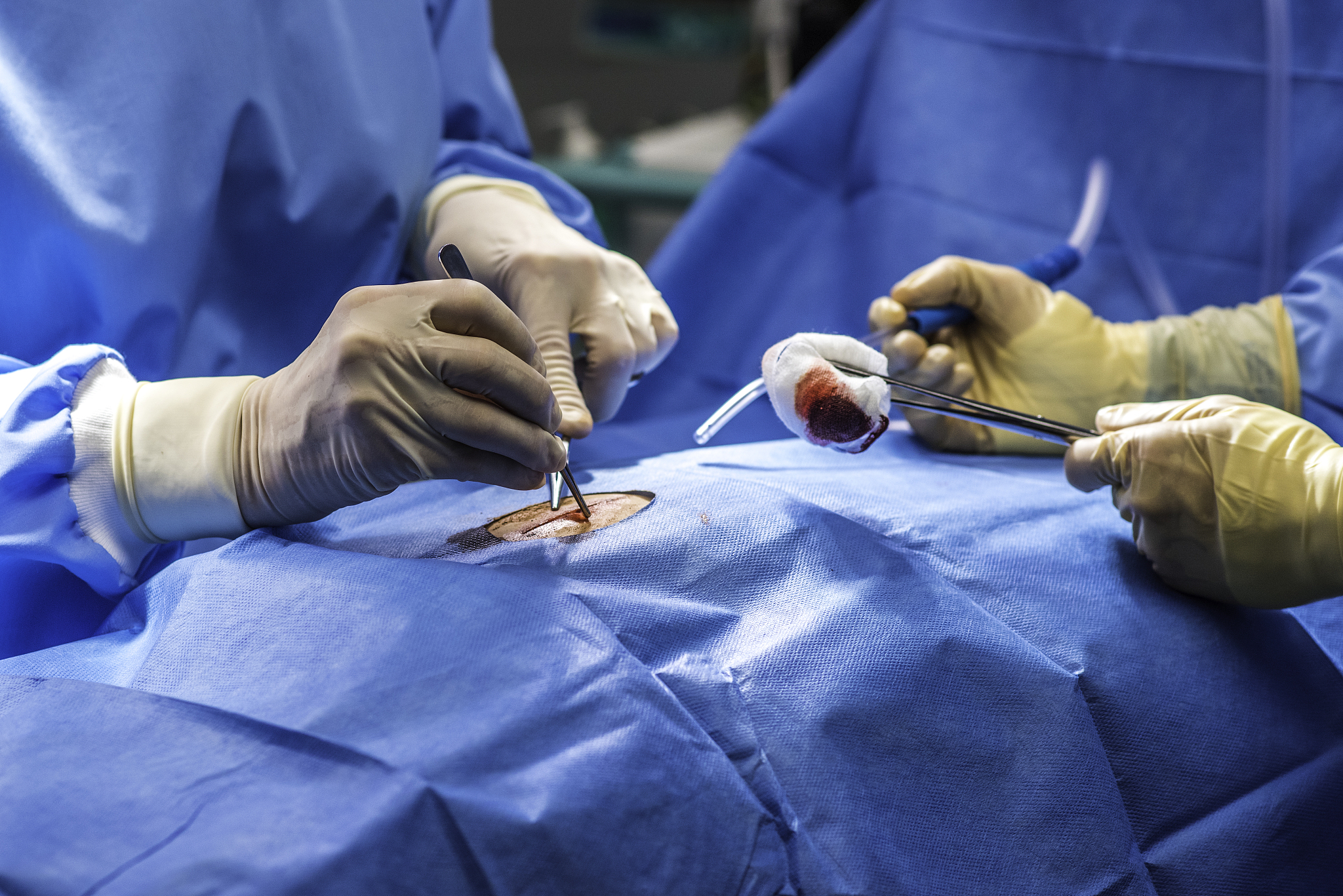 close up of surgeon operating a patient