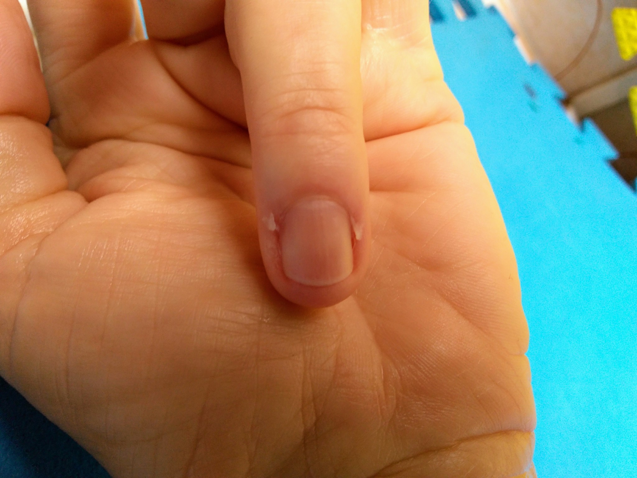 手指甲的月牙怎么补回来