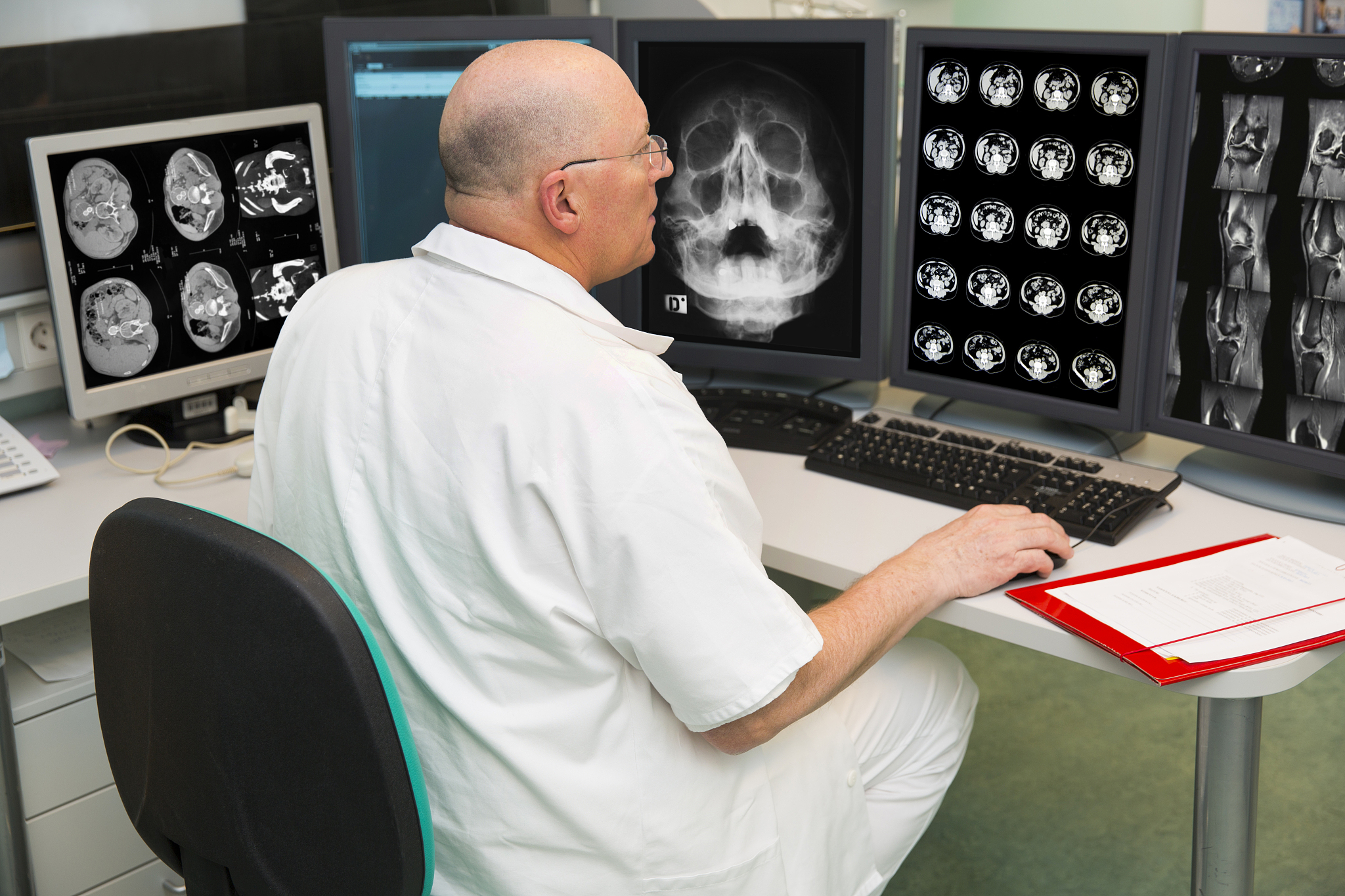 肿瘤辐射治疗的精准利器：影像靶跟踪技术综述