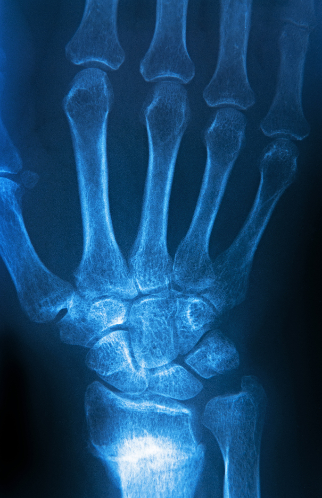 3	边缘检测：使用边缘检测算法如Canny算法、Sobel算法等检测图像中的边缘信息以便更好地分割手势。