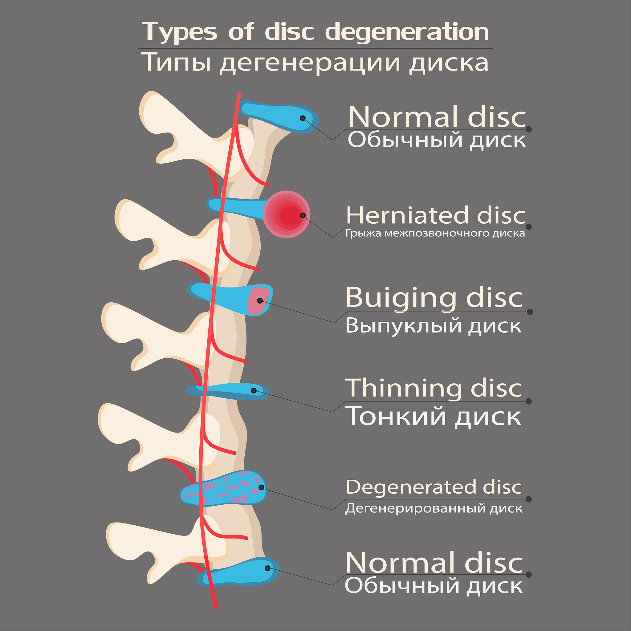 Alloy Phase Transformation: Definition, Types & Applications