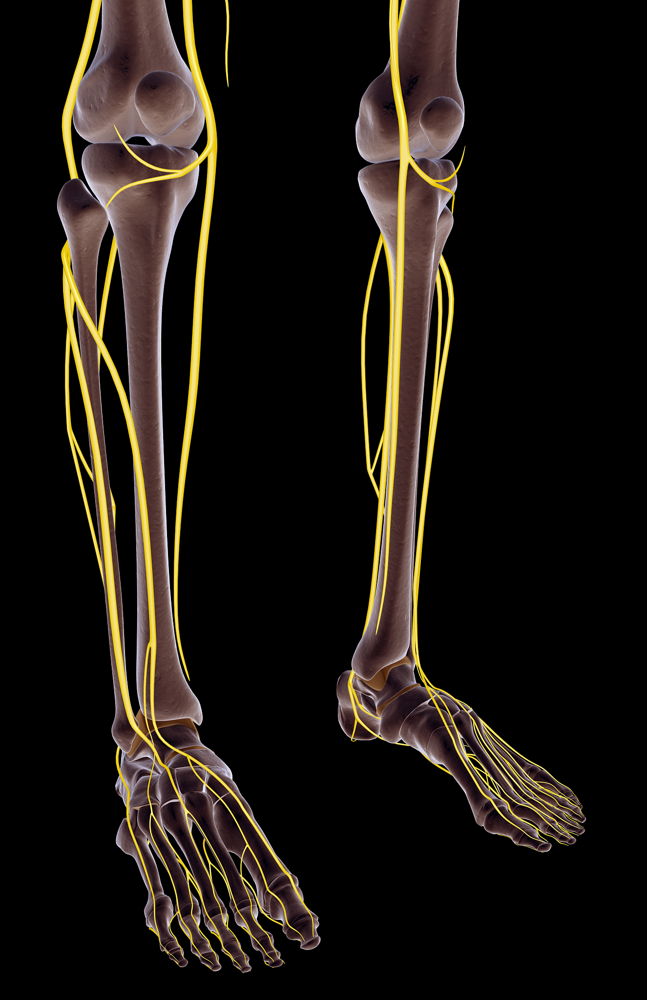 小腿弯曲可以矫正吗，