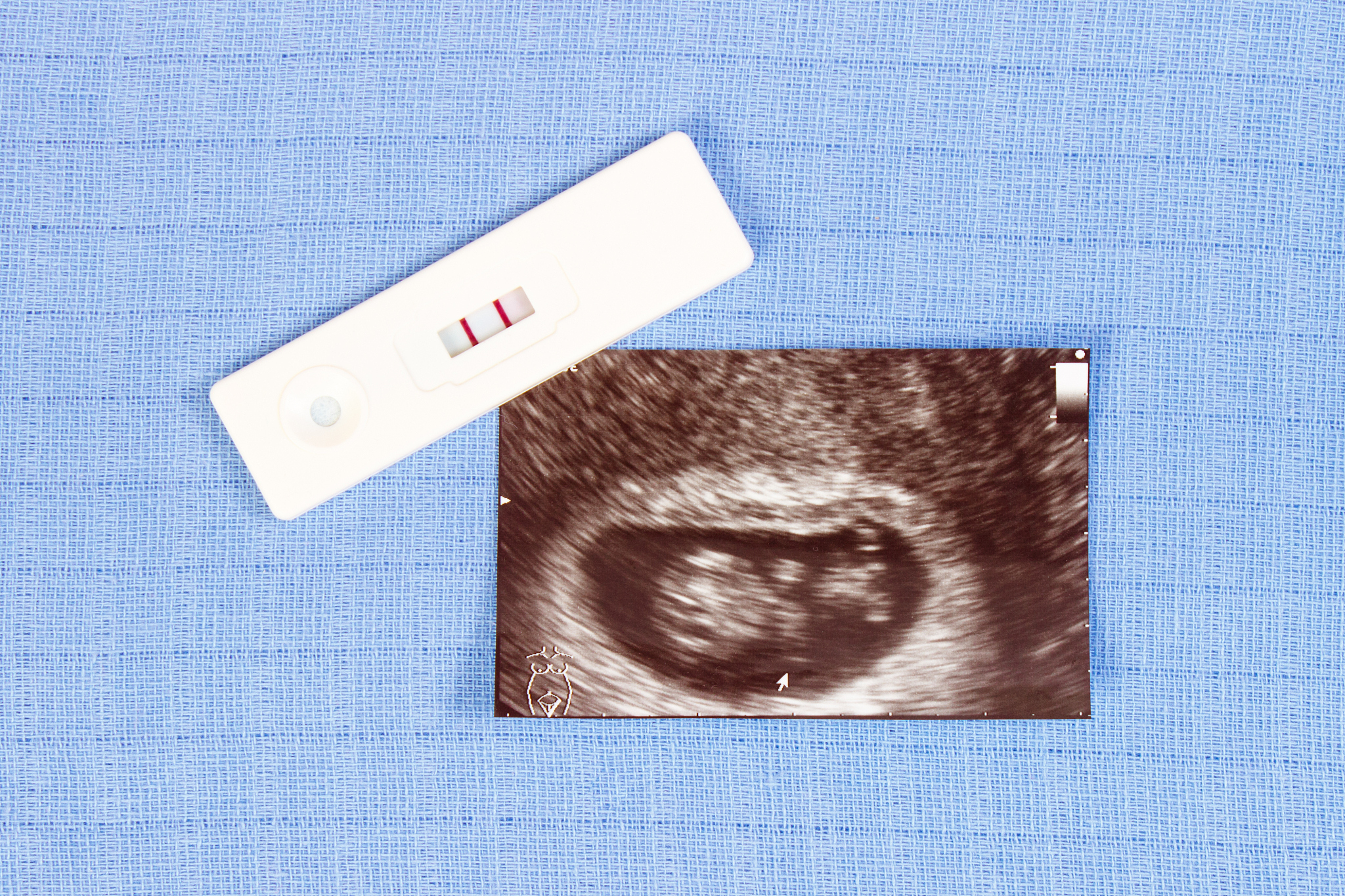 我需要你作为一名SEO帮助我把对应的关键词变为包含多个需求且吸引人的SEO长标题但要注意长标题不可以是疑问句以下是内容：取卵后内膜厚度正常值