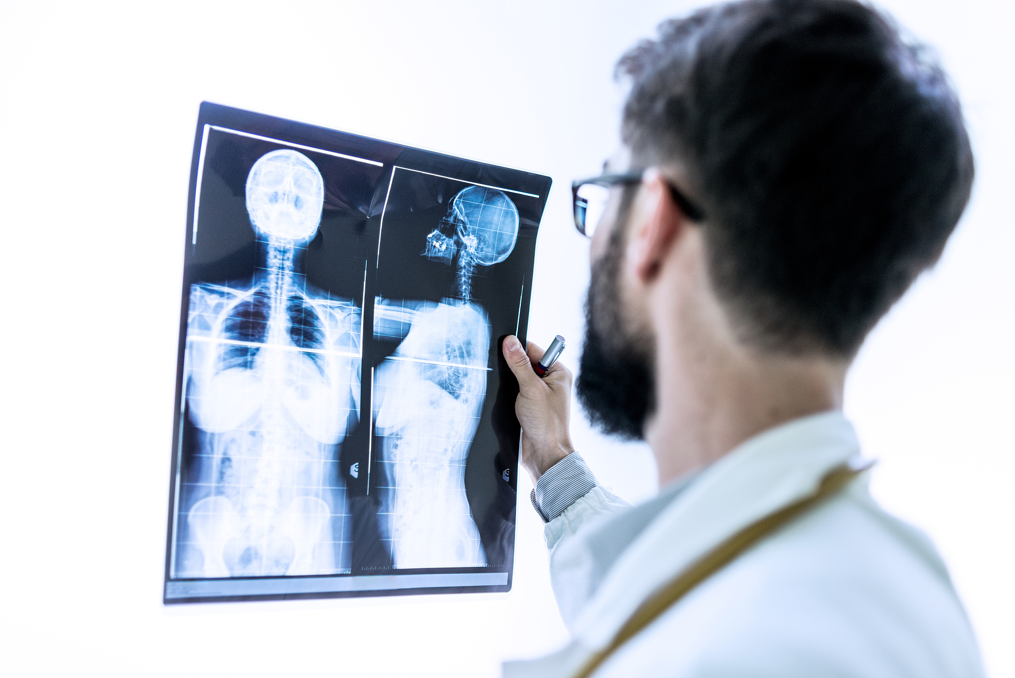 医学影像技术好不好