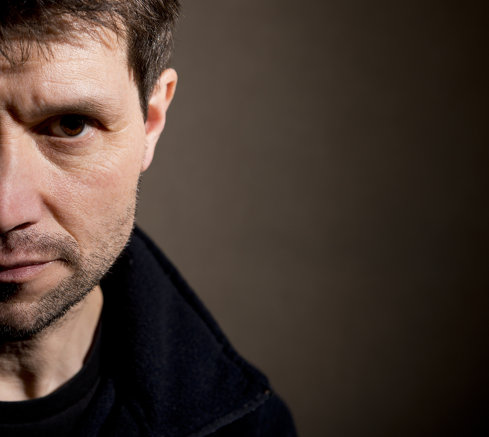 高脂血症重症急性胰腺炎