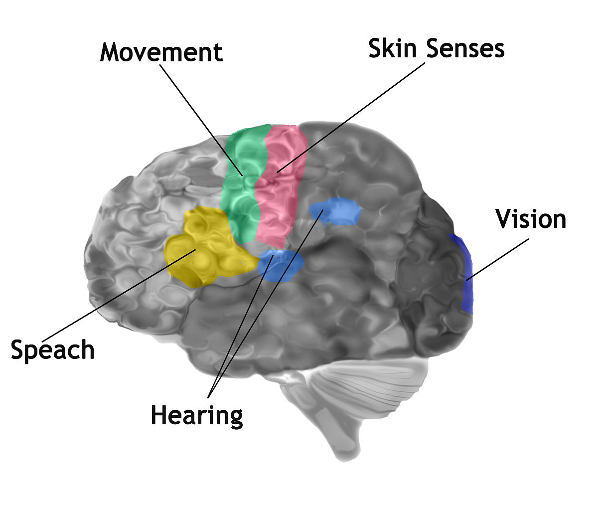 头针针刺运功疗法治疗偏瘫60例疗效分析方法：取穴：百会穴、病灶侧运动区、