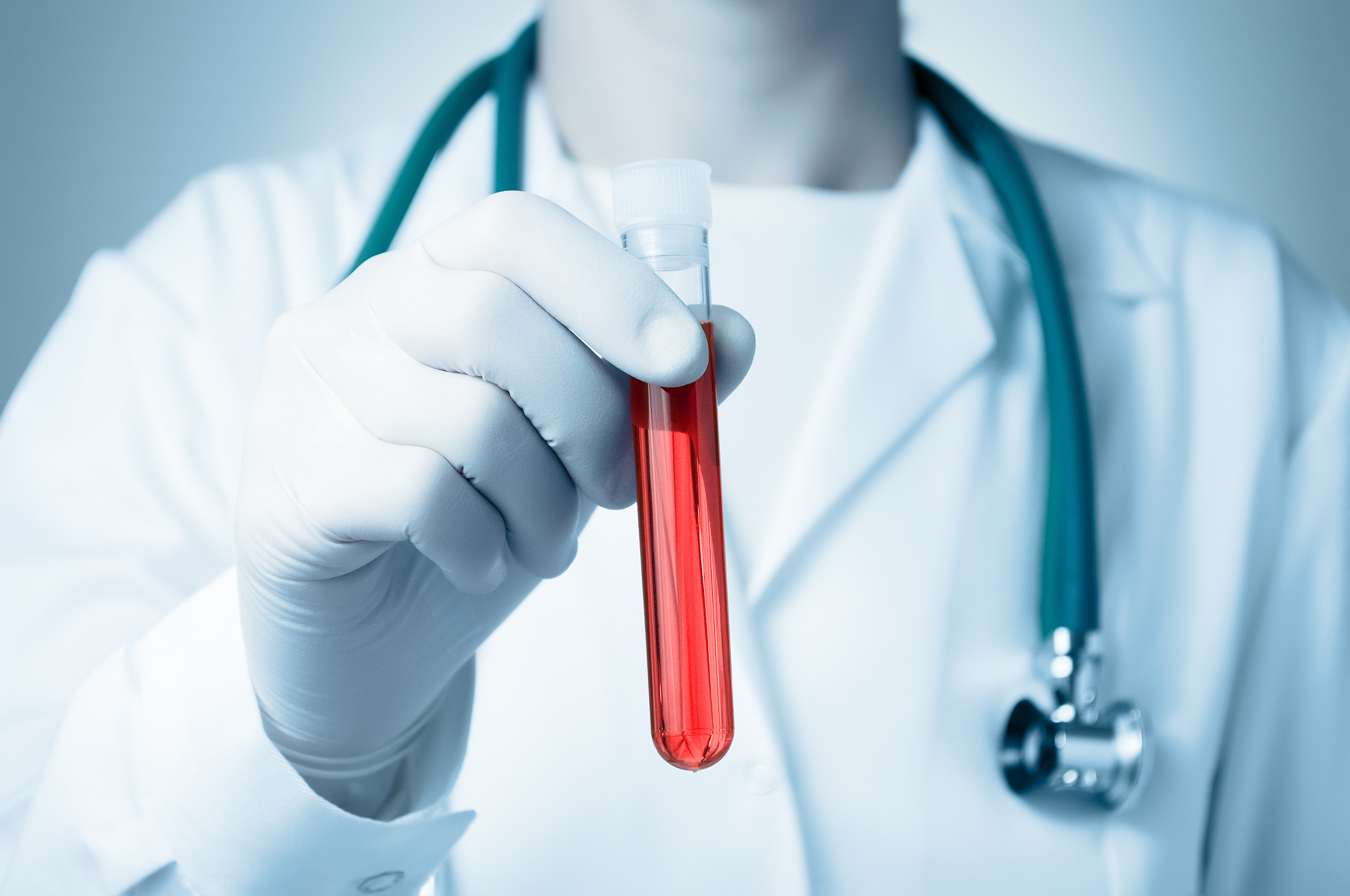 hand with blood sample