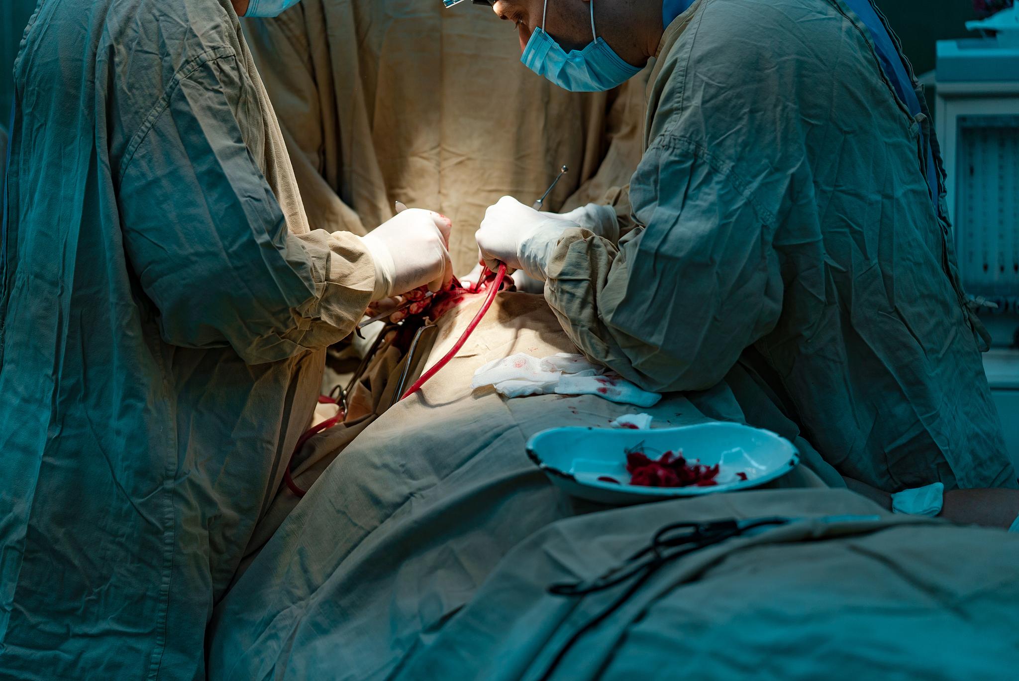 surgeons stand over the face of a man and perform an operation i