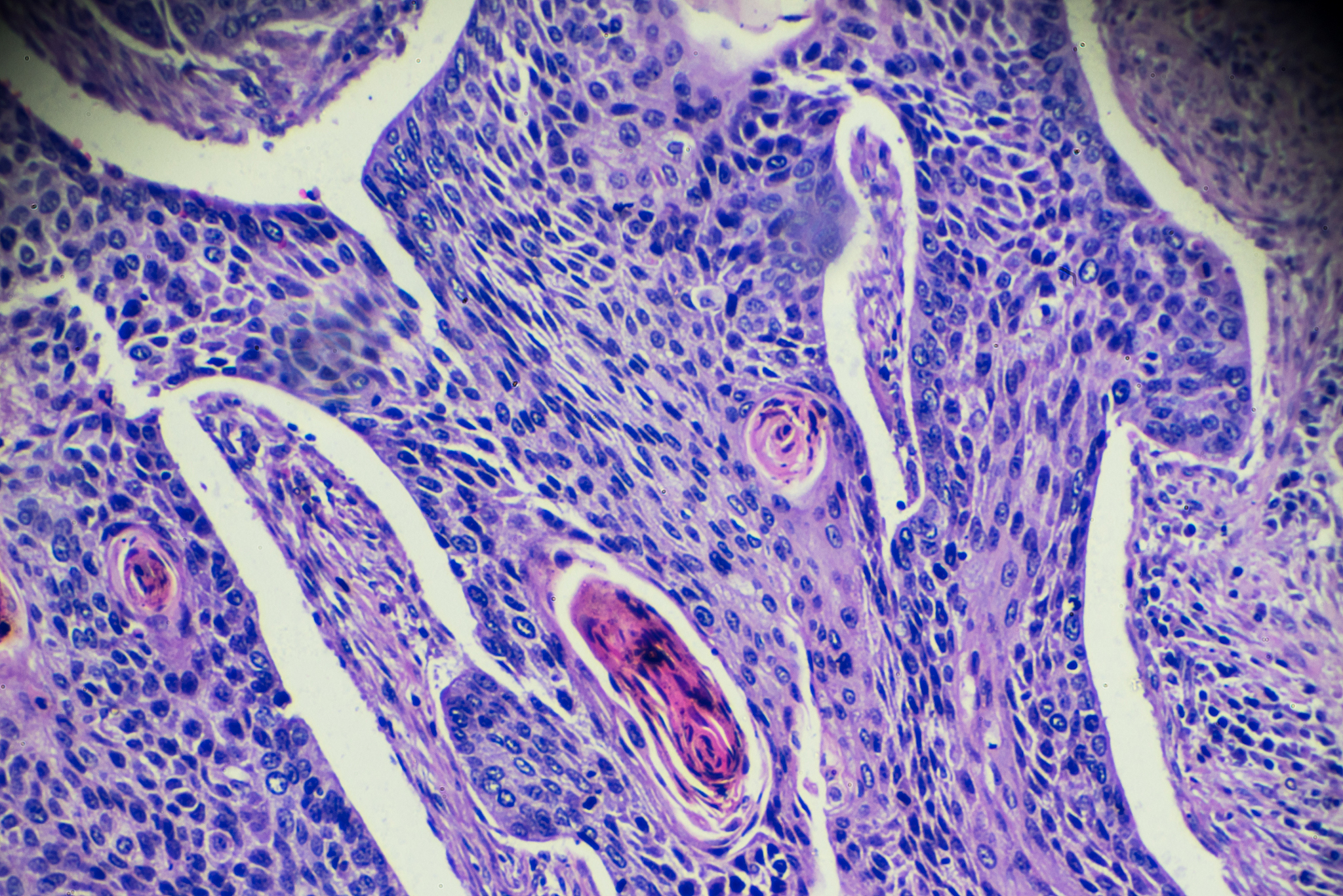胸外科见习反思：从肺部疾病到肺癌的探索与感悟