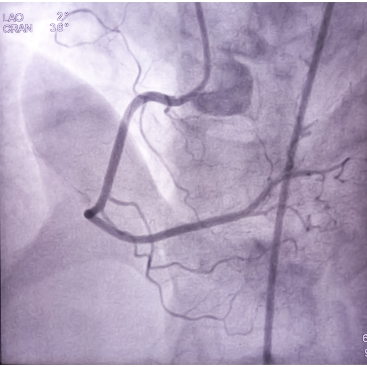 医学影像学如何革新冠状动脉成像技术？