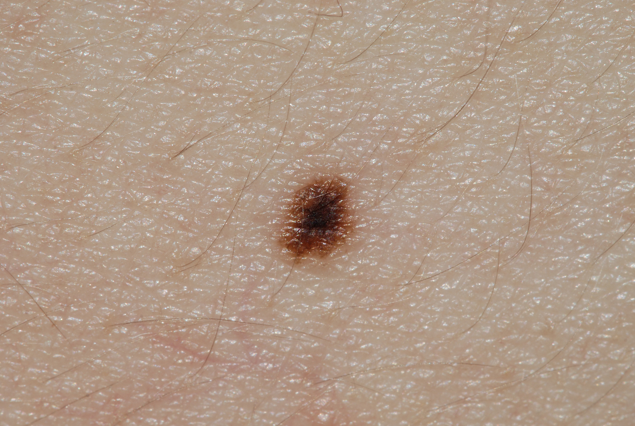 mole skin macro
