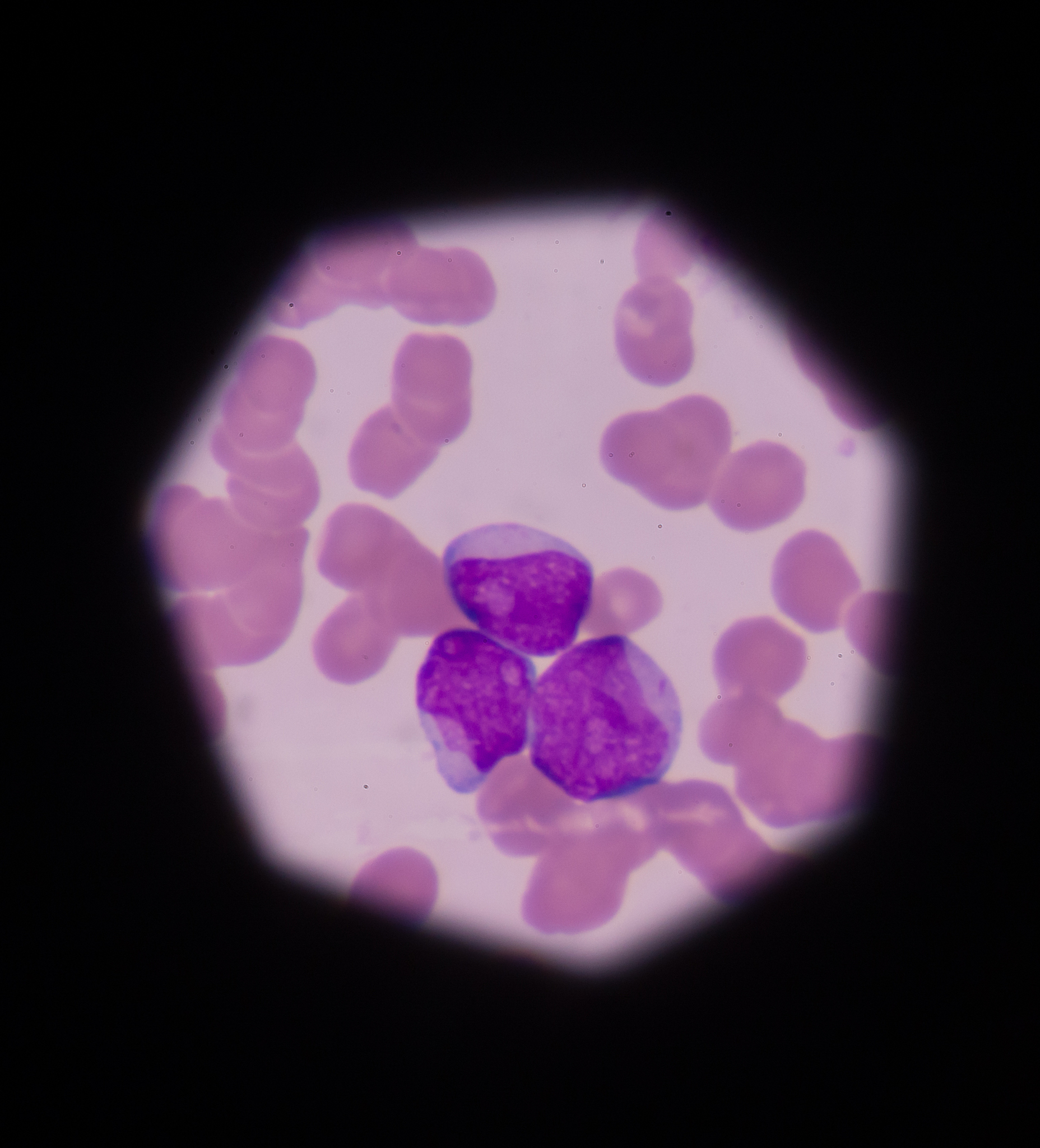 人血血红蛋白计数正常范围