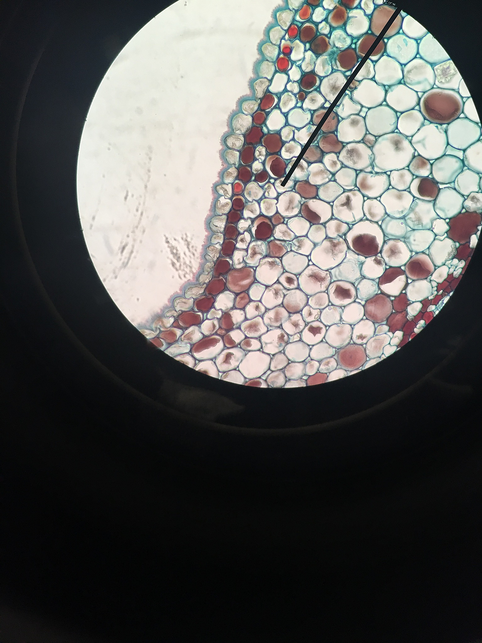 口腔组织病理学角度描述乳中切牙形成过程