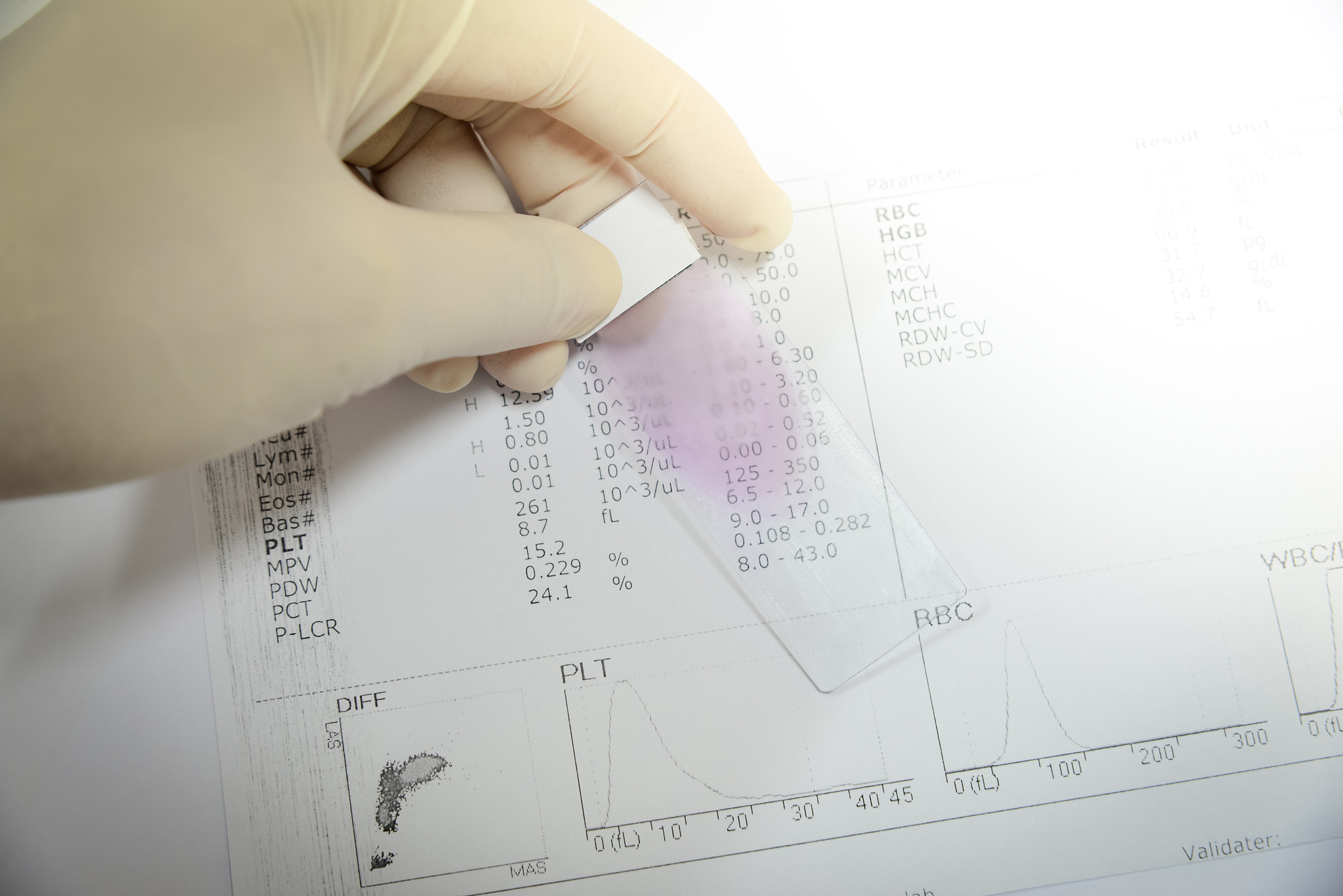 白血病放疗各种不良反应发生率多少？