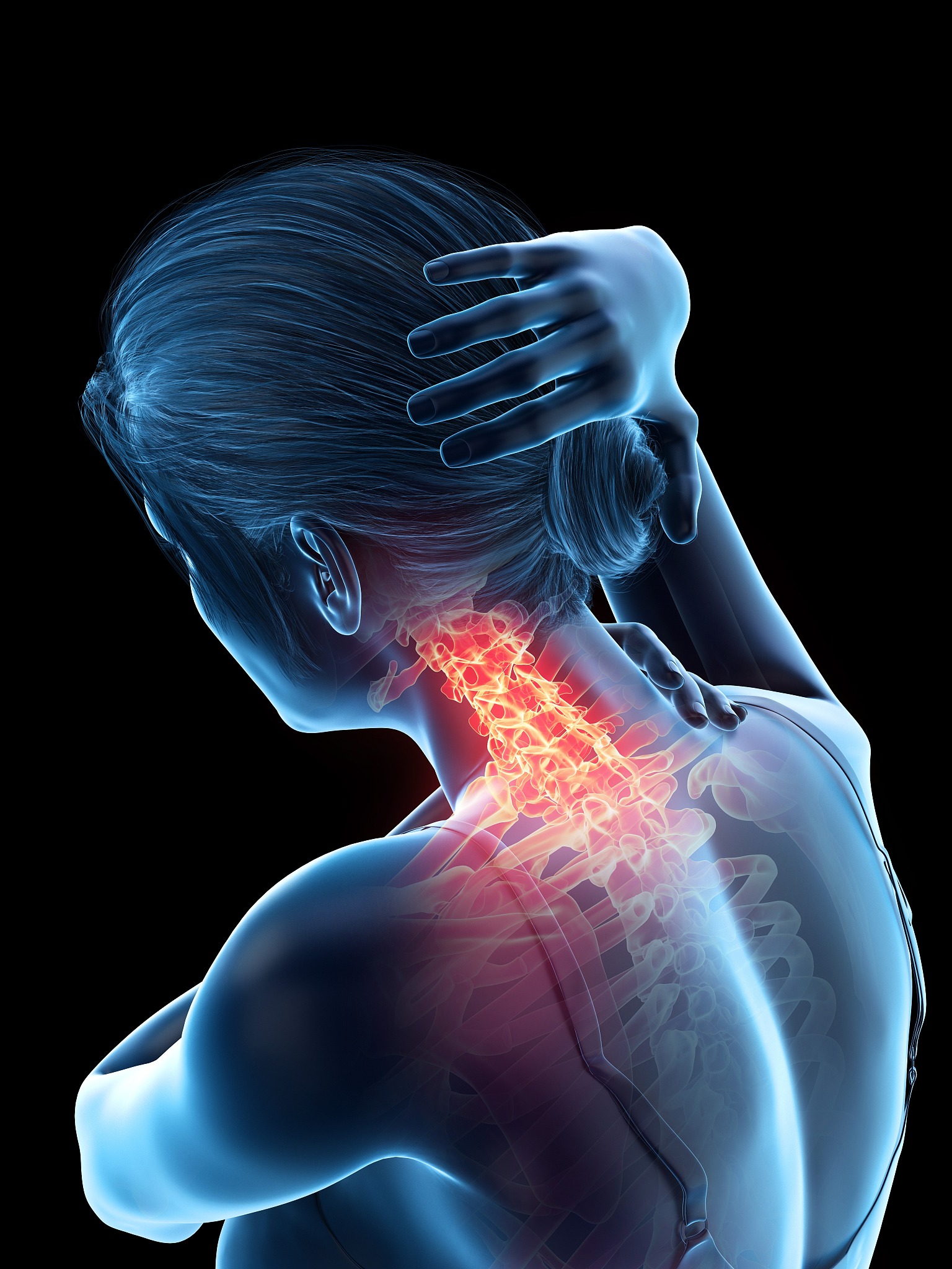 woman with a painful neck, illustration