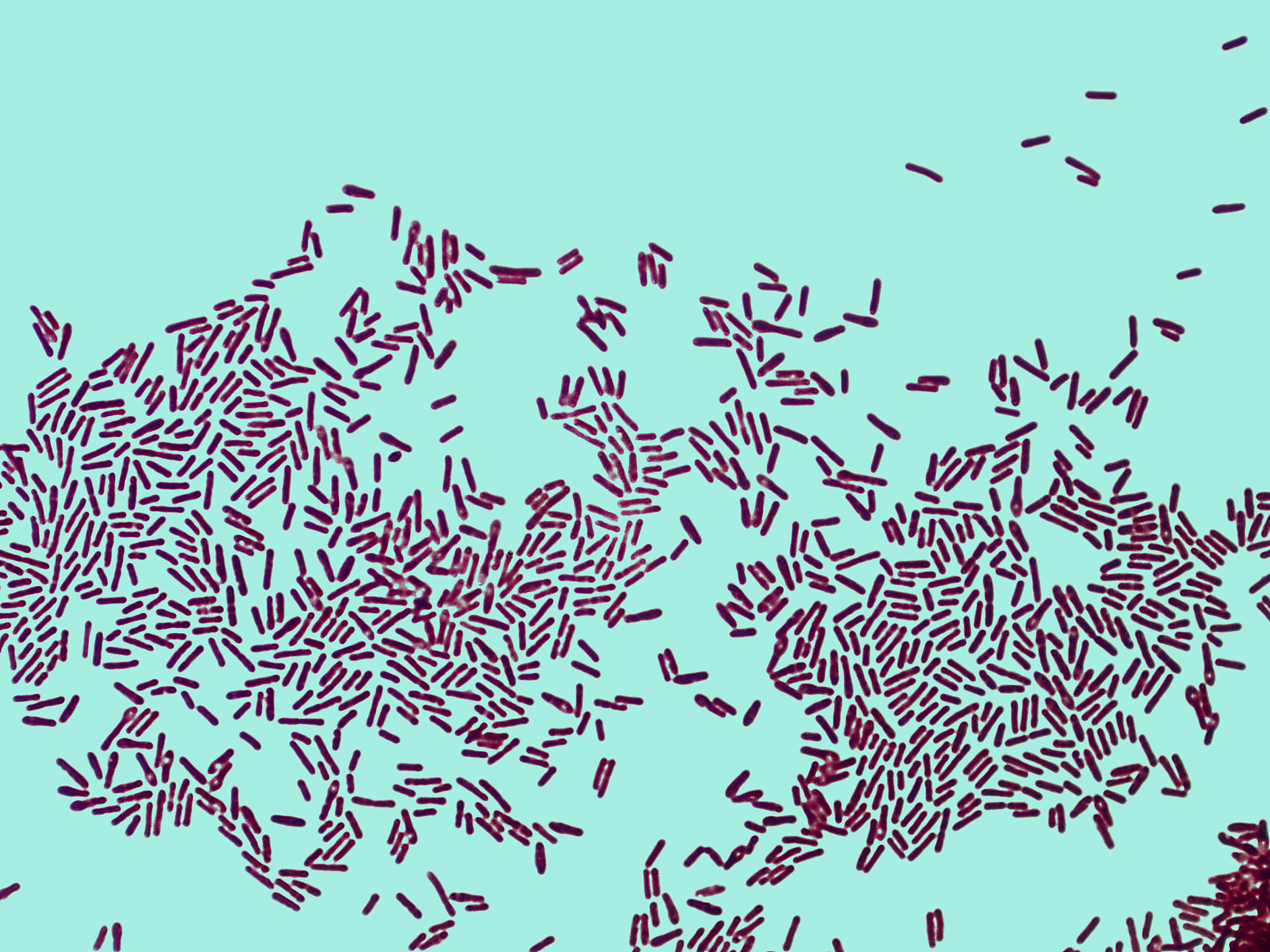 Gammaproteobacteriaγ-变形菌纲、Enterobacterales	肠杆菌目、Pseudomonadales假单胞菌目、Enterobacteriaceae肠杆菌科、Moraxellaceae莫拉氏菌科、Acinetobacter不动杆菌属、Sutterella萨特拉菌属、Klebsiella克雷伯氏菌属、Klebsiella_pneumoniae和Klebsiella_vari