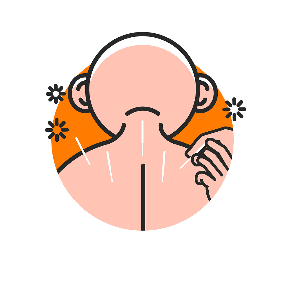 acupuncture needles being applied on neck