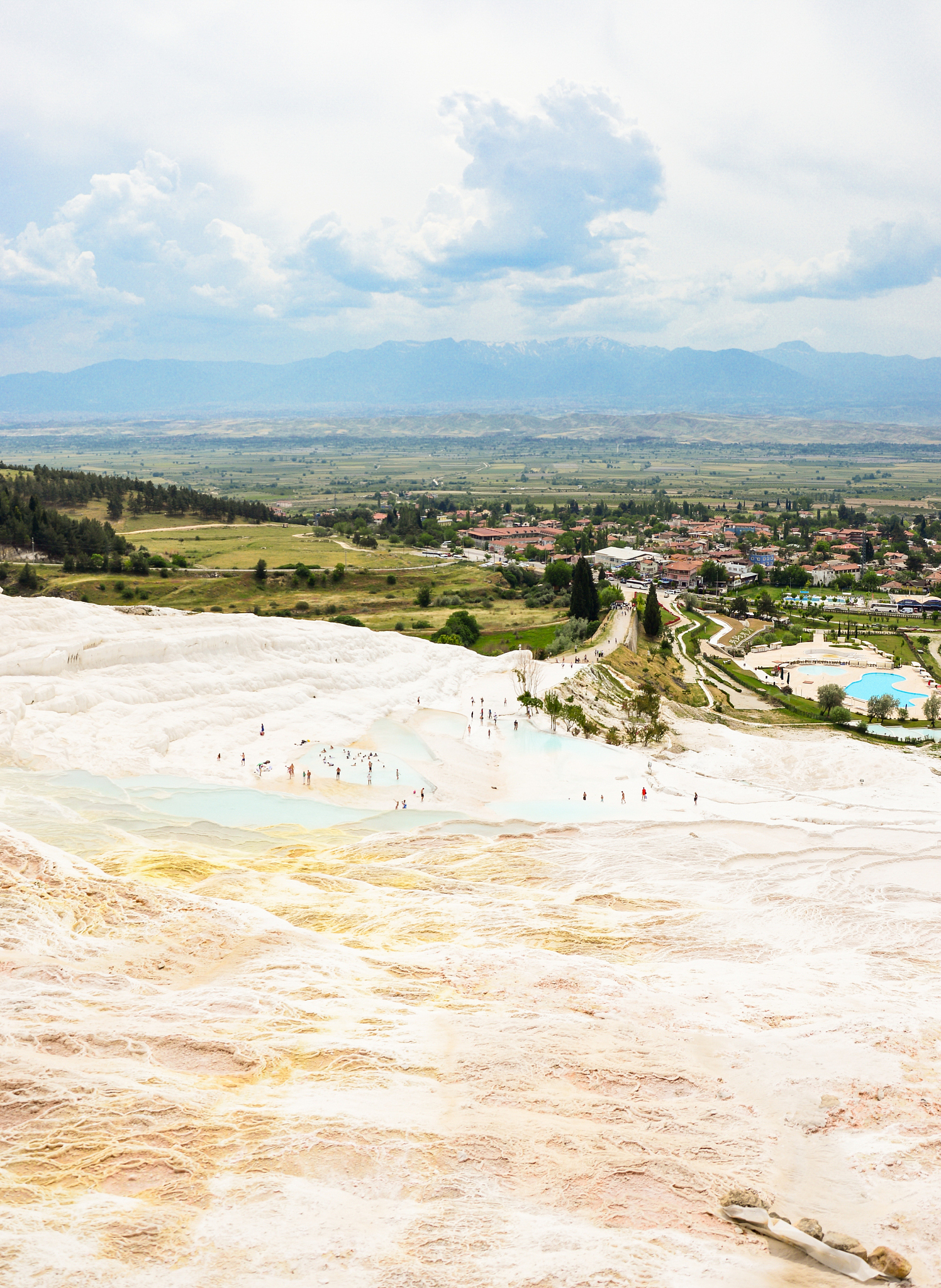 高氯血症导致酸中毒的原因及症状