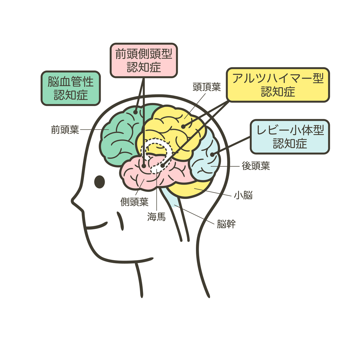 怎样防止脑子变傻