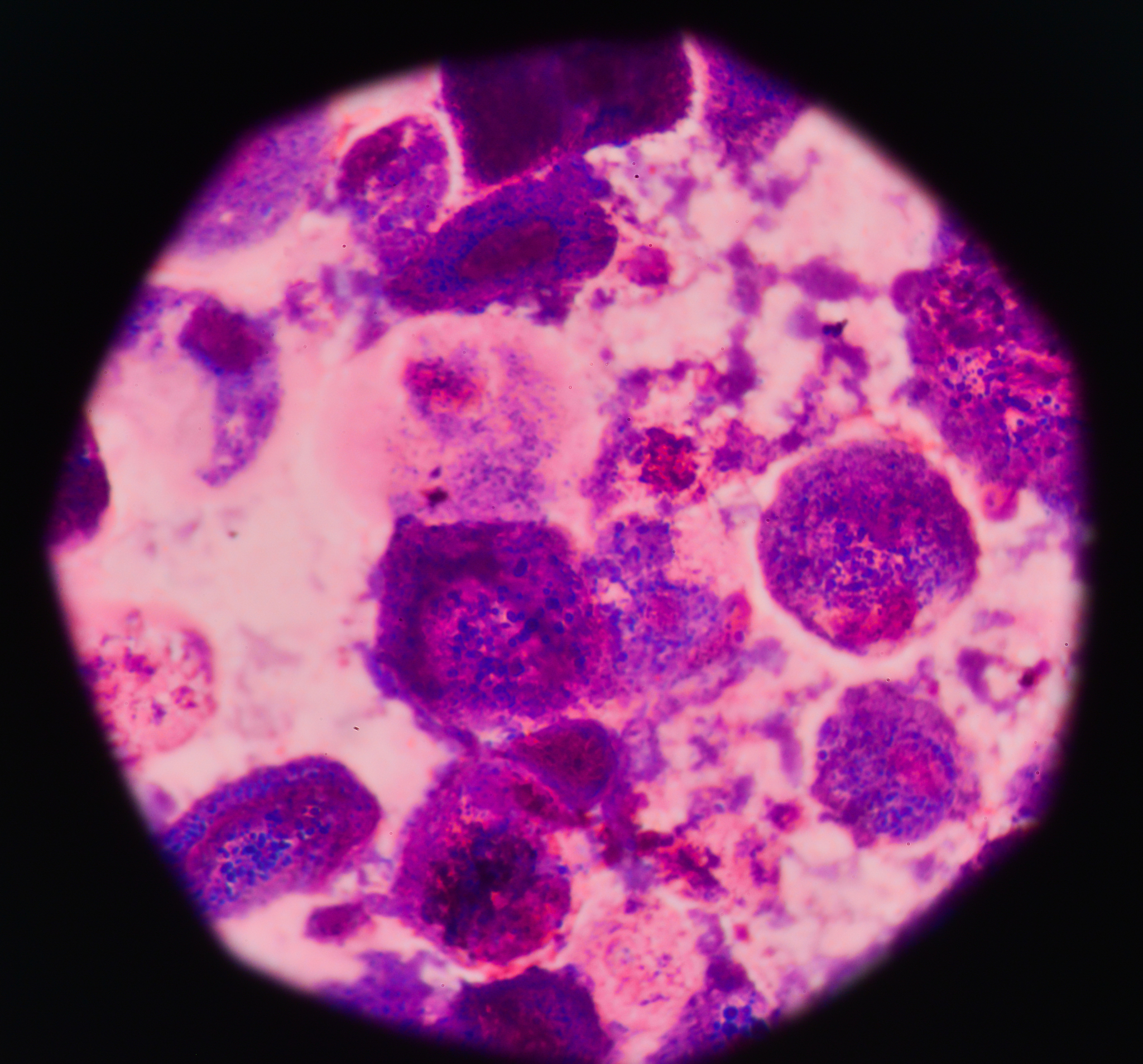 中性粒细胞显微镜下的颜色：细胞核和细胞质