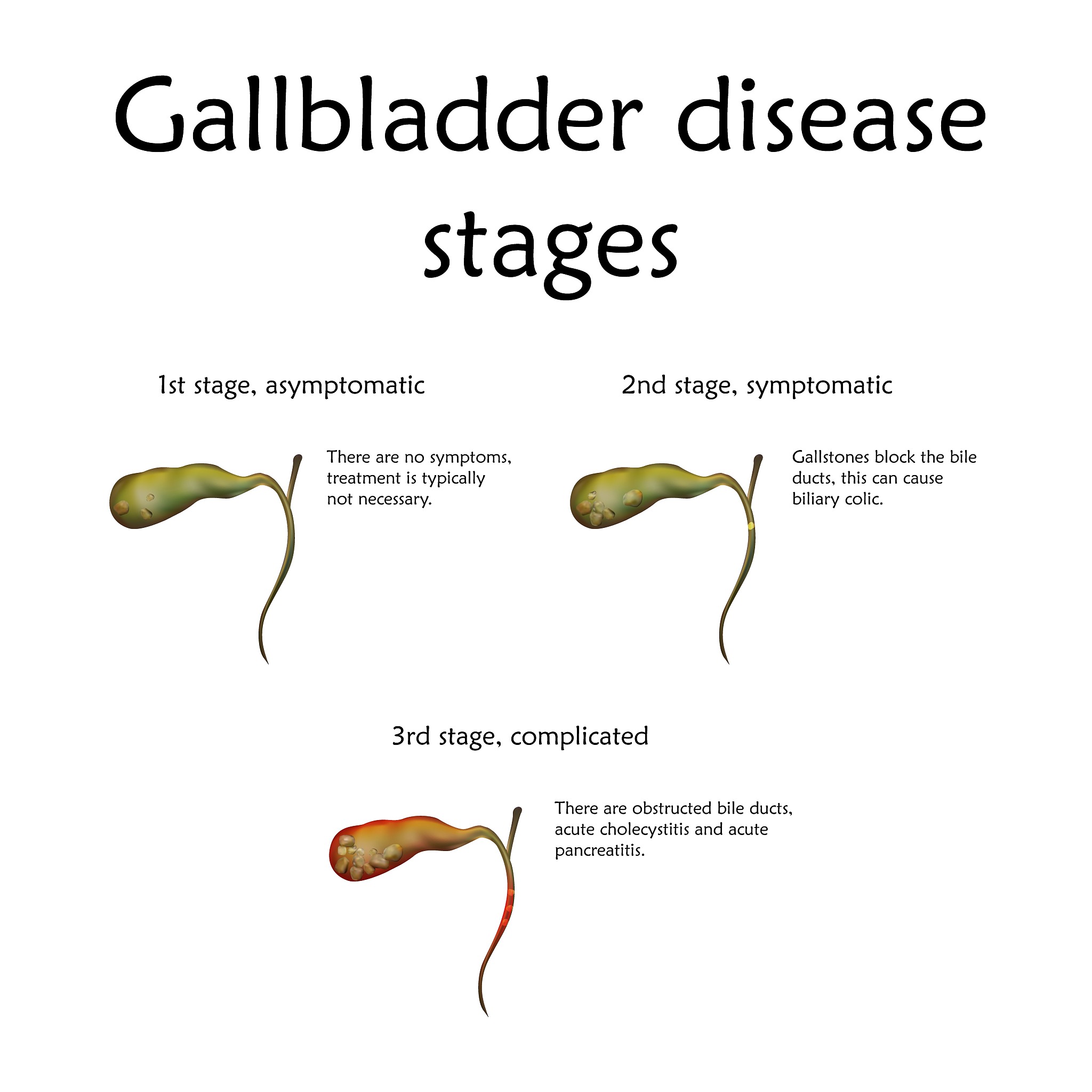 Ternary Phase Equilibrium Point on Succinic Acid Crystallization Curve