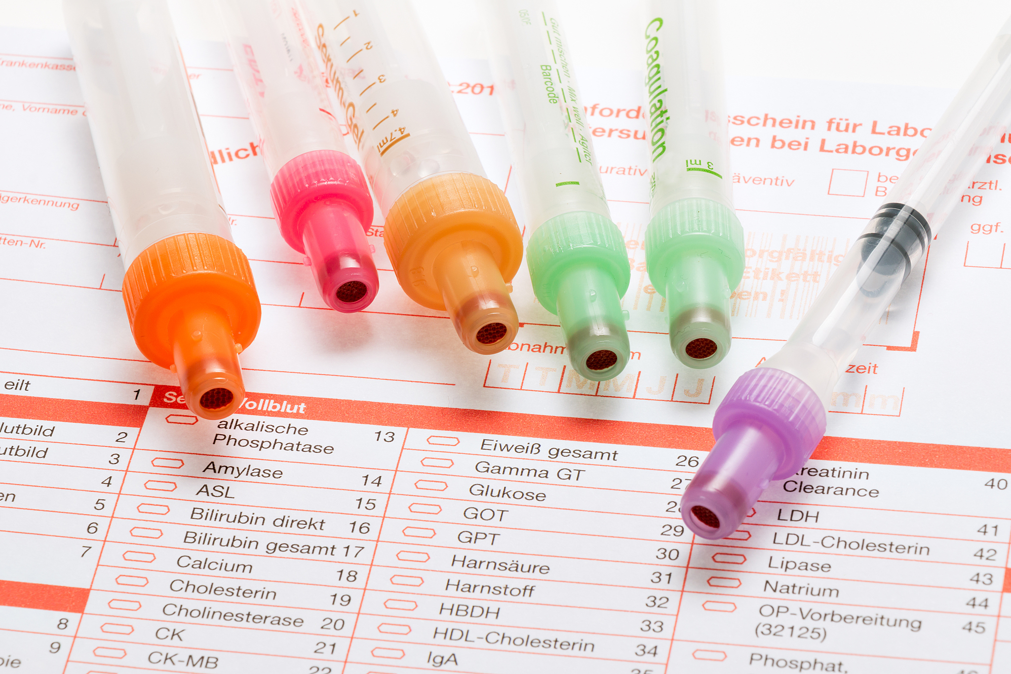 医学检验中血液细胞检验的质量控制影响因素