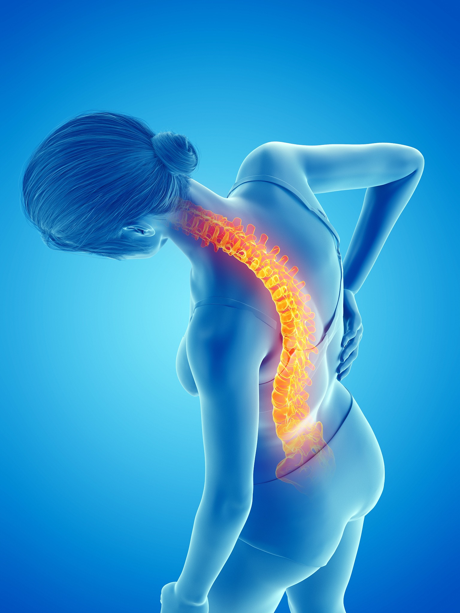 woman with a painful back, illustration