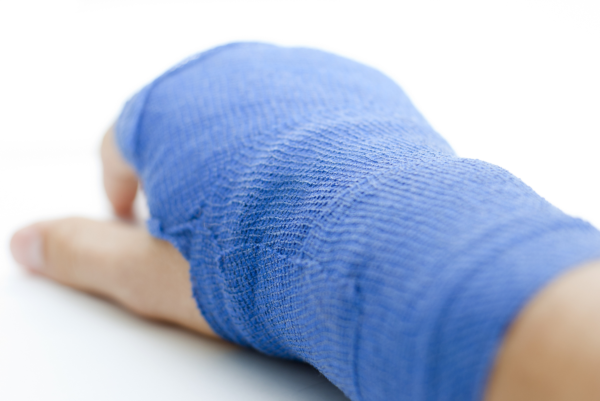 hand bandaged in blue plaster