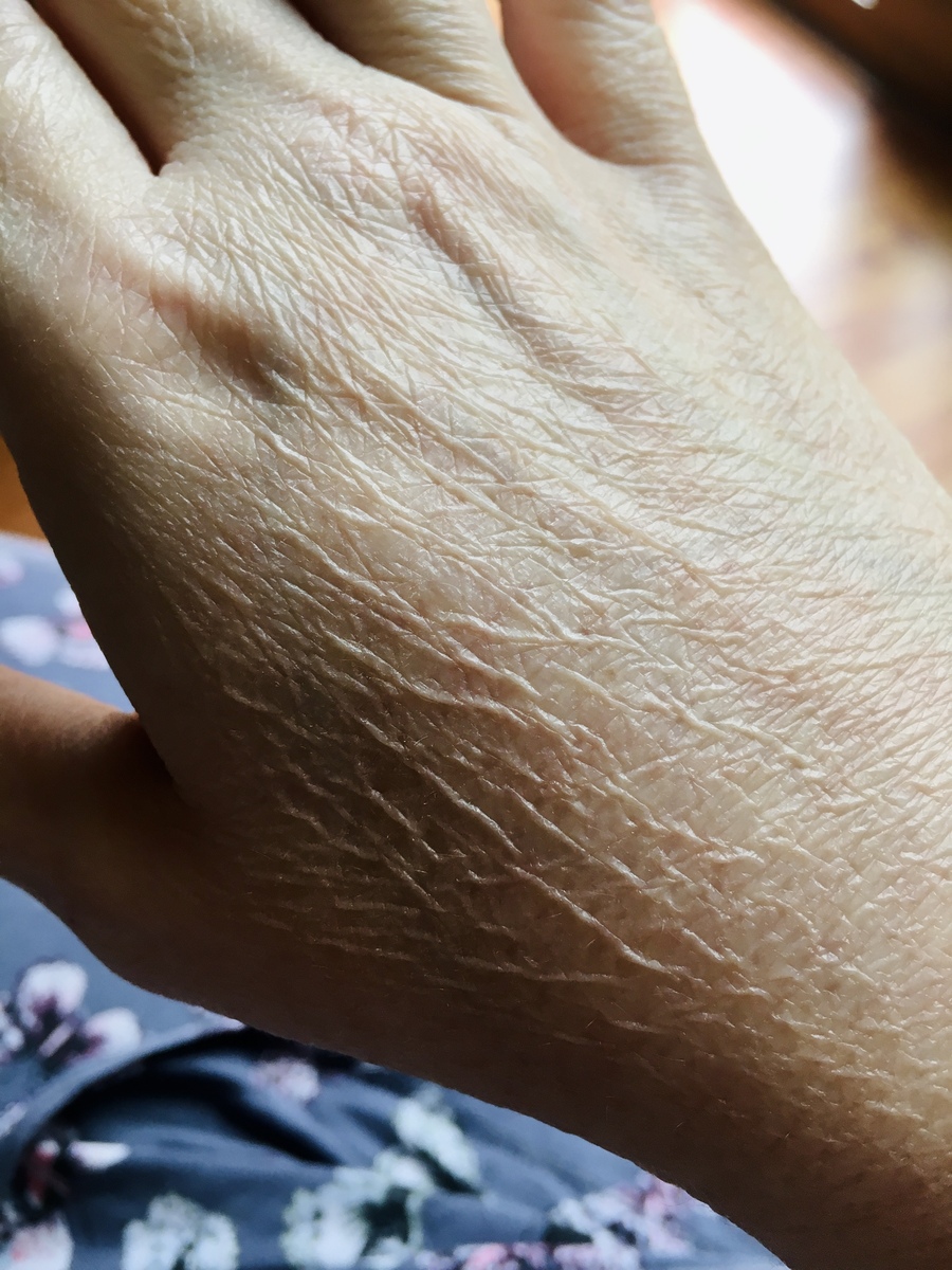 脱毛剂对人体伤害