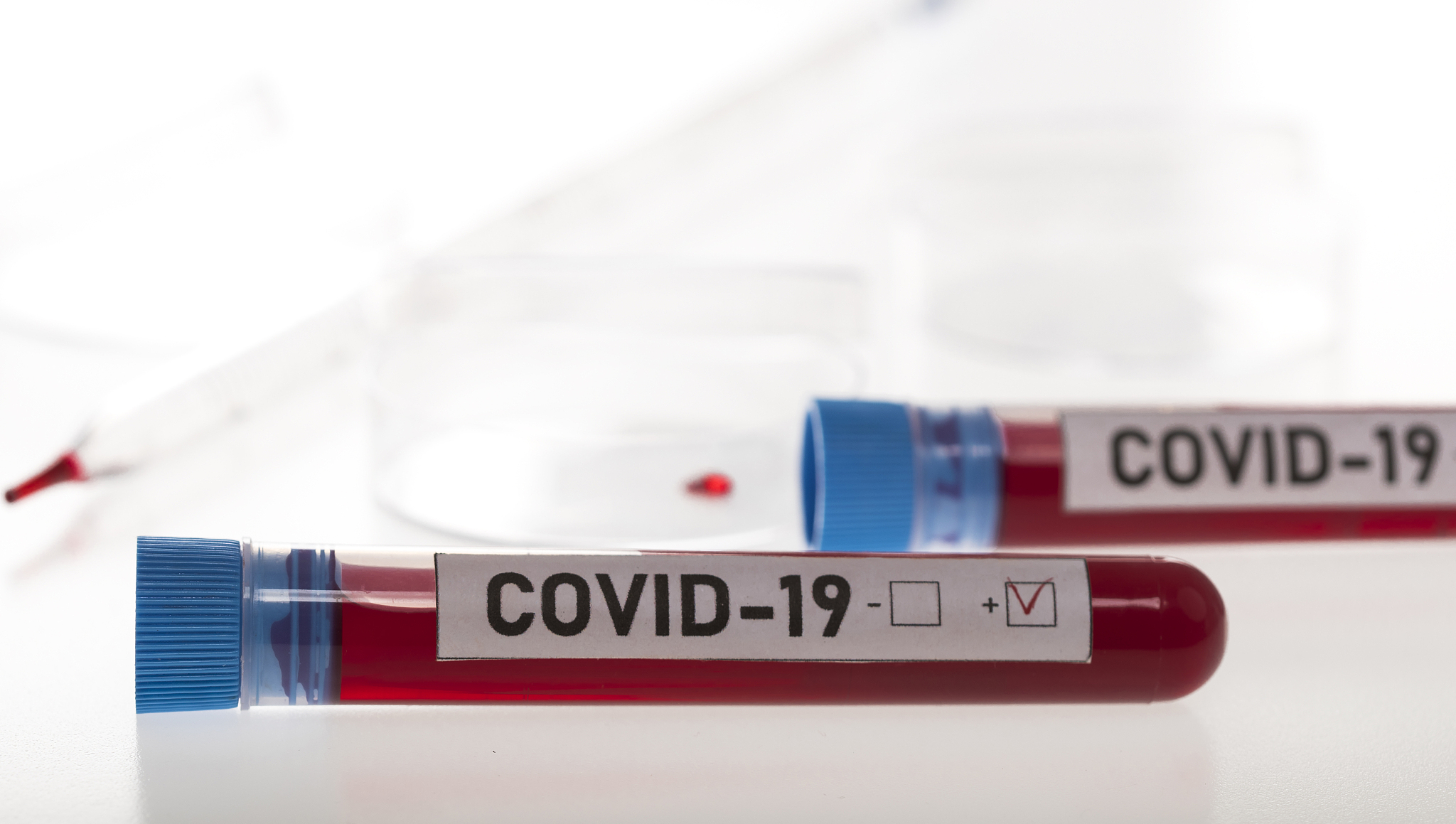tubes of biological sample contaminated by coronavirus with labe