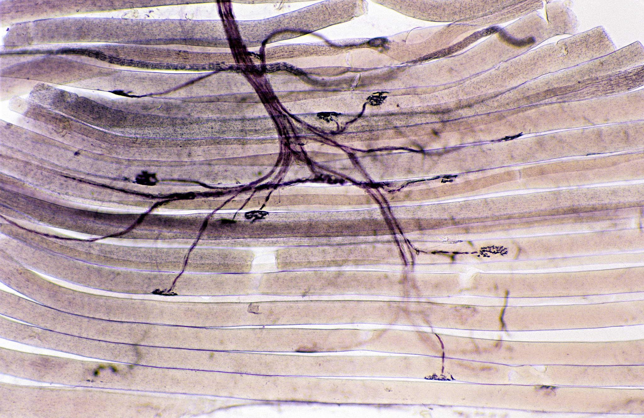 钙脉冲：定义、功能和作用机制
