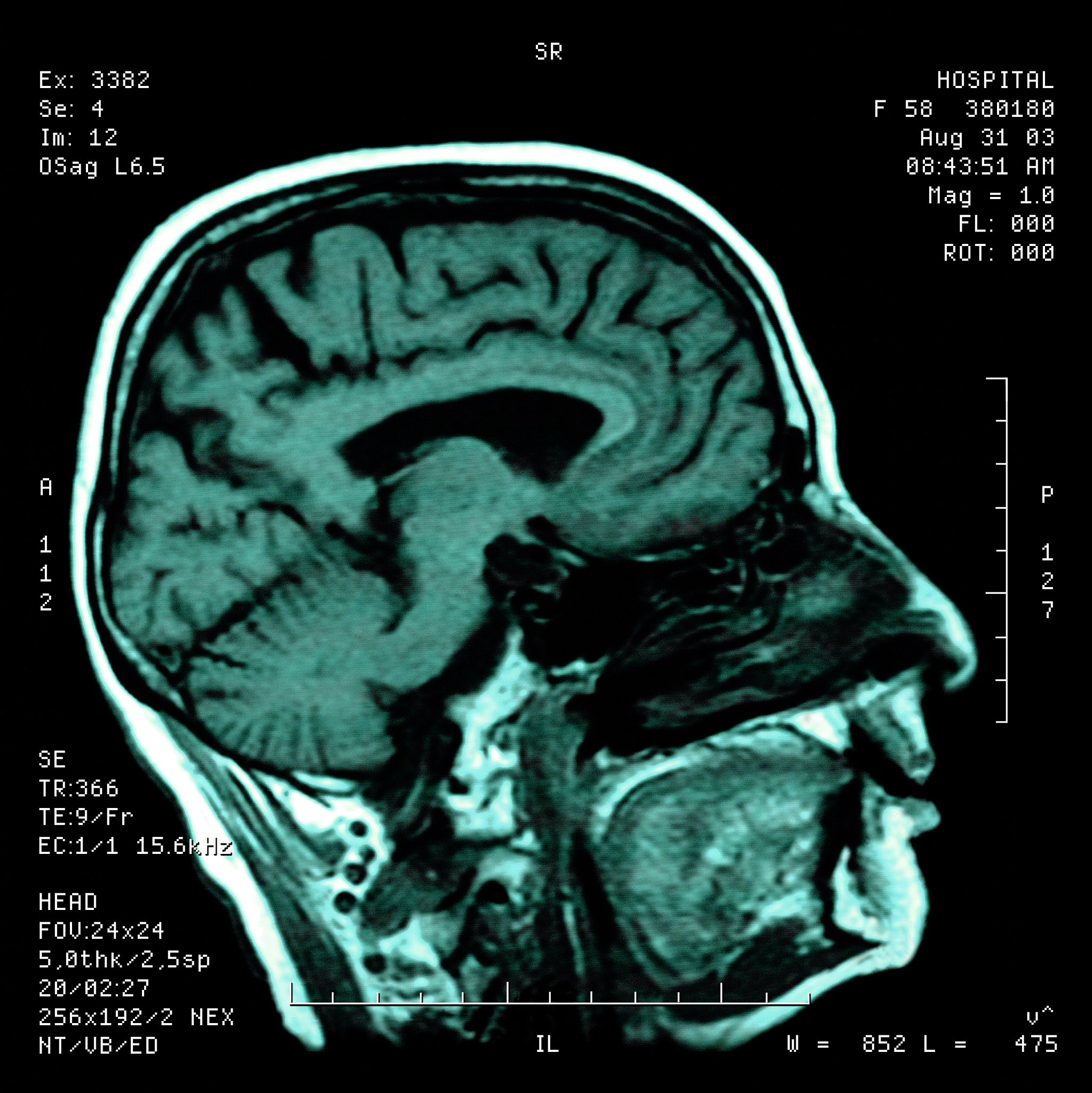 重庆医专卫生检验与检疫技术专业招生 - 未来发展前景广阔