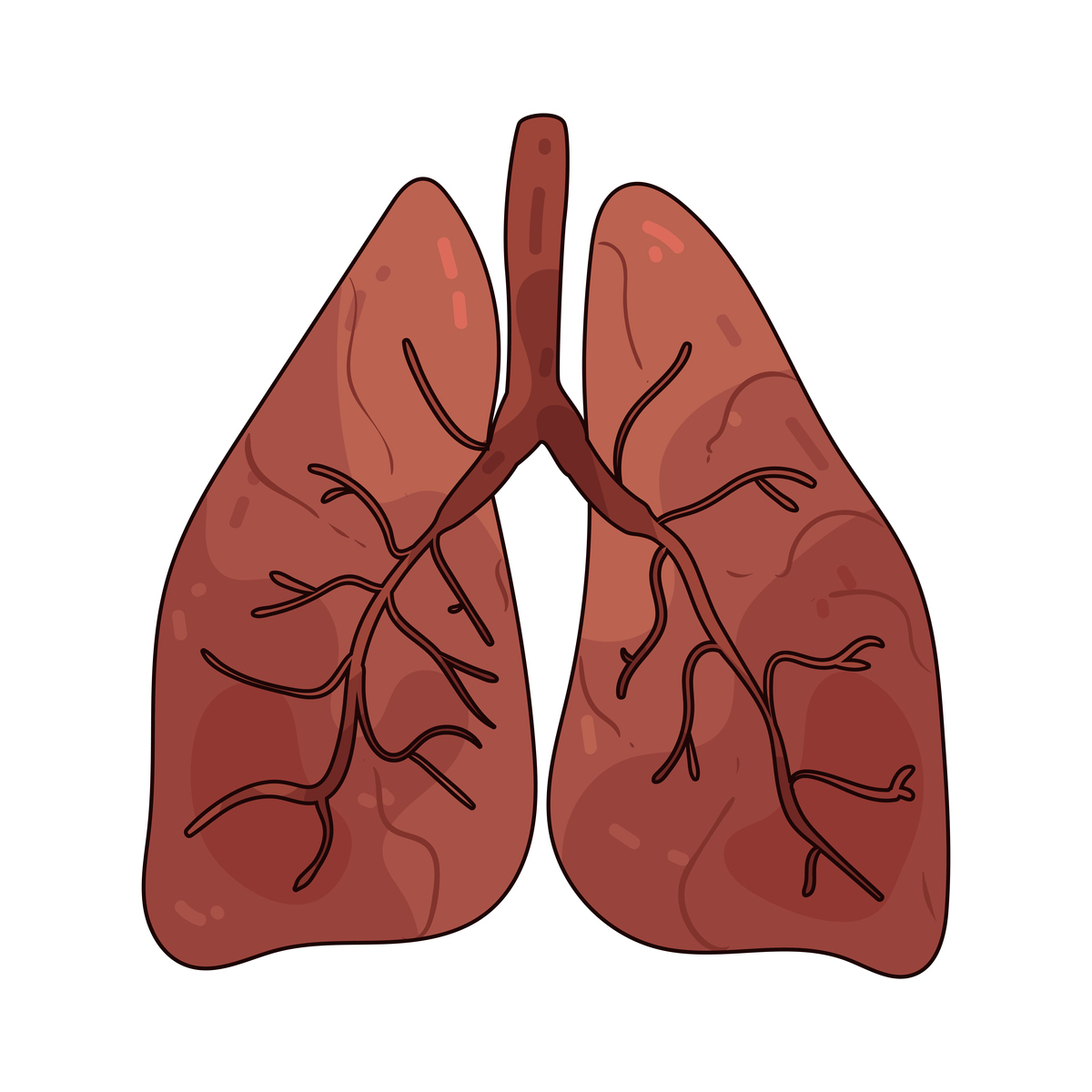 脓毒血症呼吸衰竭预防：肺部感染、肺栓塞、气胸