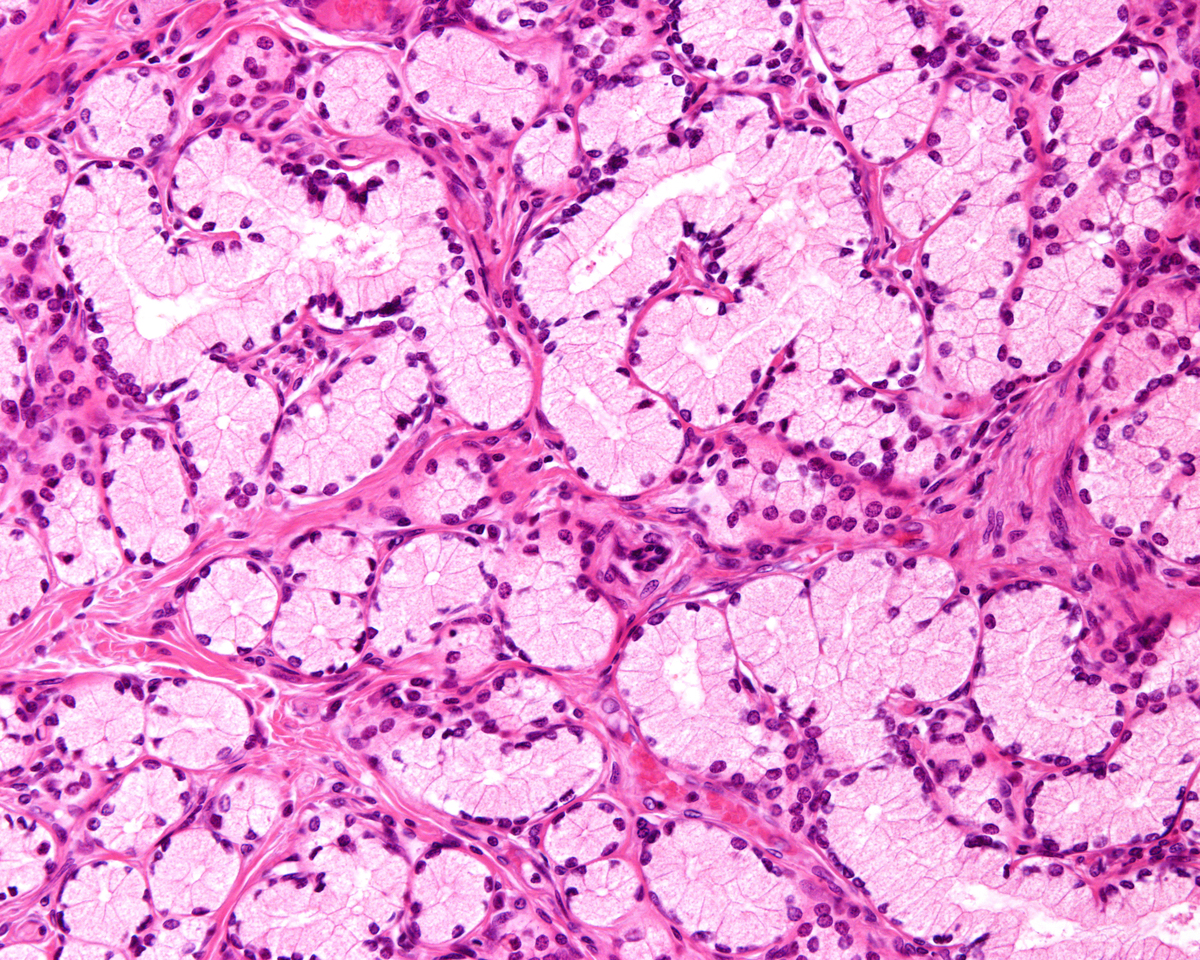 肝细胞癌细胞与正常肝细胞的鉴别方法